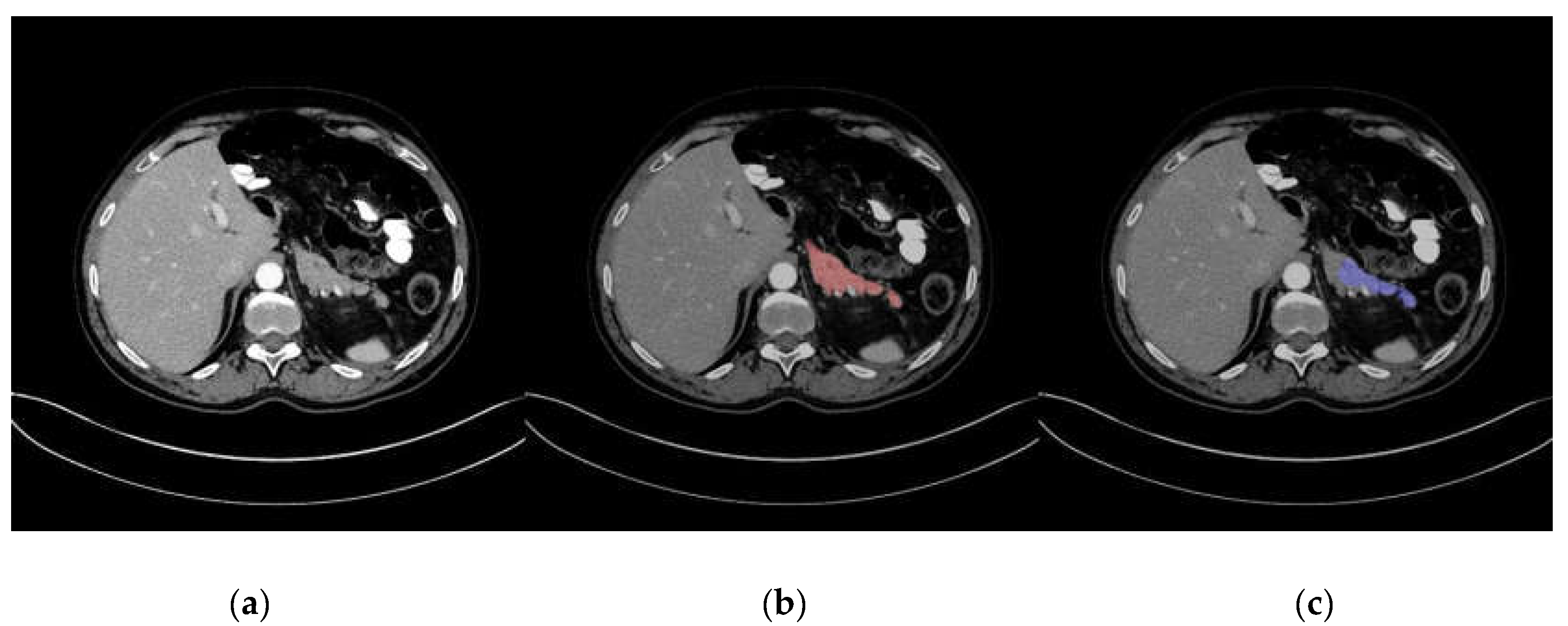 Applsci 10 03360 g003 Applsci 10 03360 g003