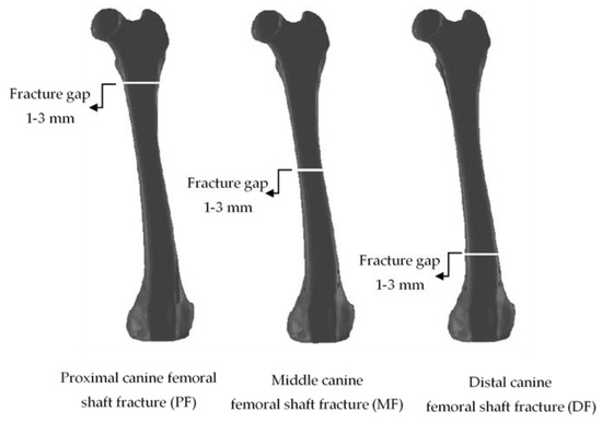 Titanium Cannulated Tibial Nail with Proximal Bend