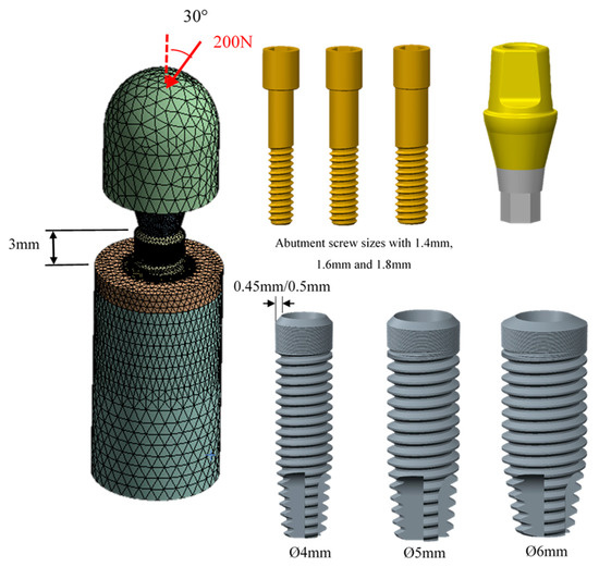 Applied Sciences | Free Full-Text | Biomechanical Evaluation of