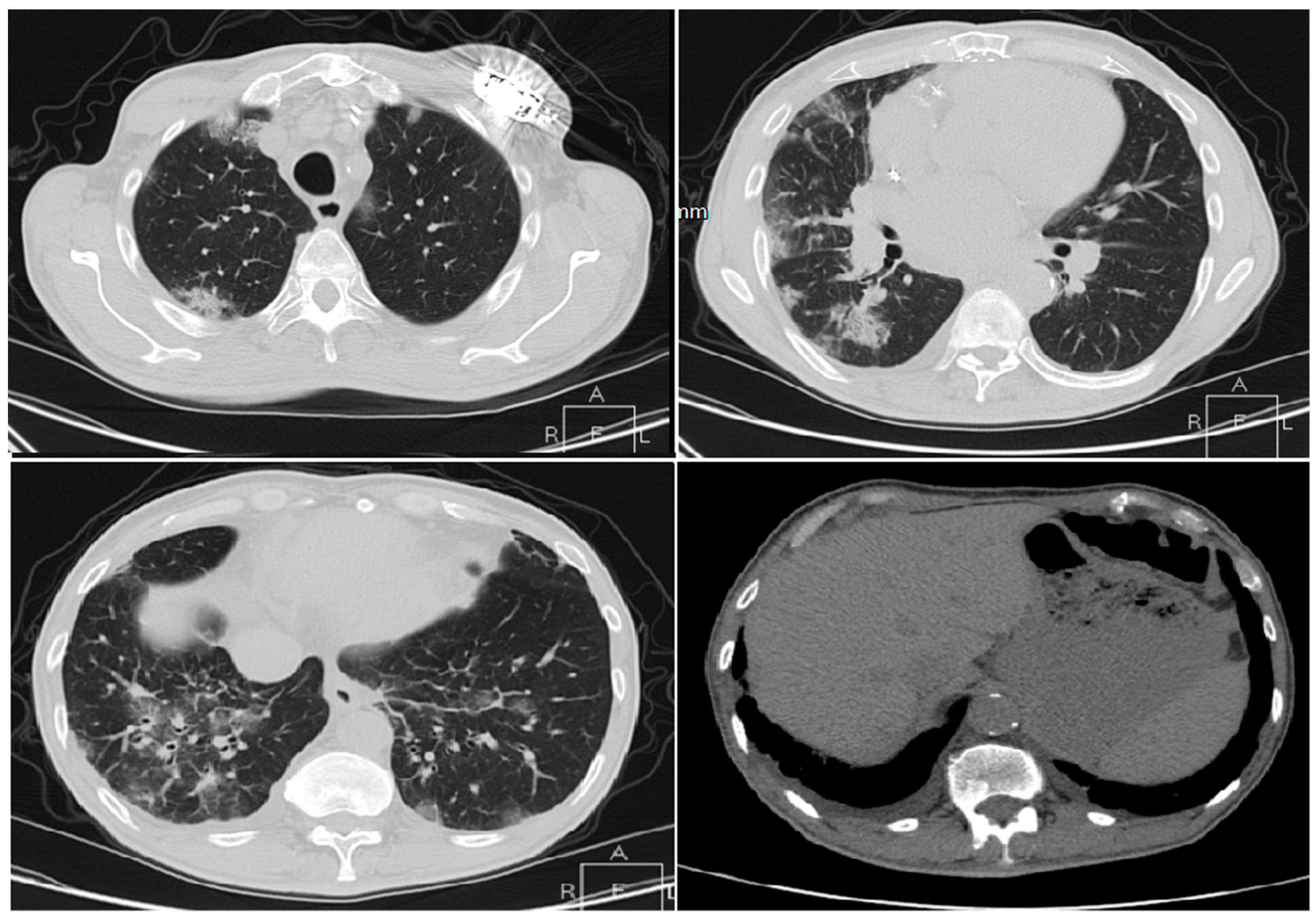 Applsci 10 03641 g008 Applsci 10 03641 g008