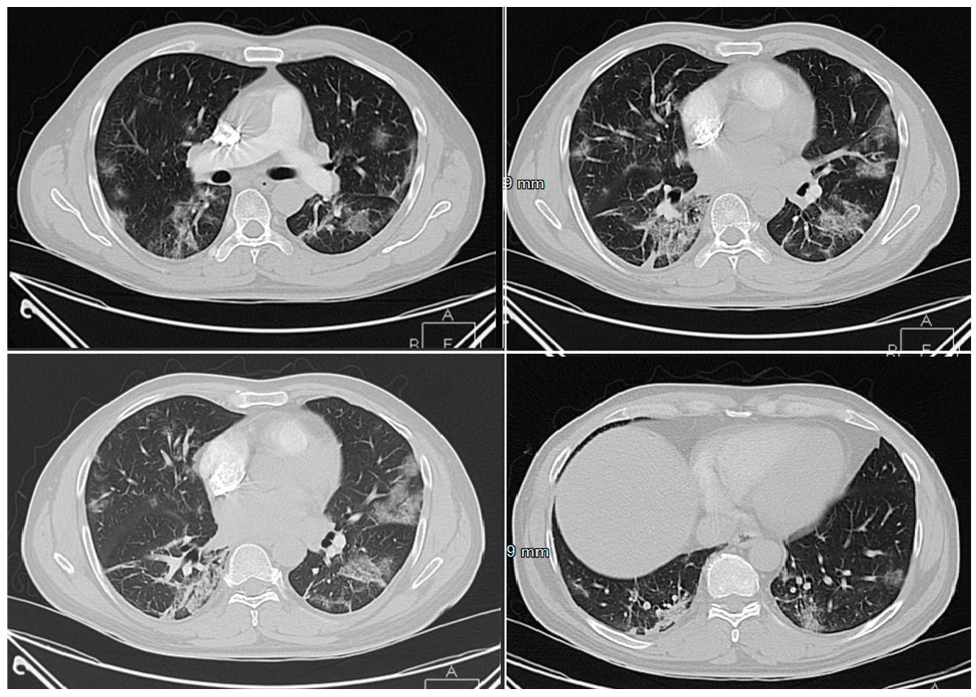 Applsci 10 03641 g009 Applsci 10 03641 g009