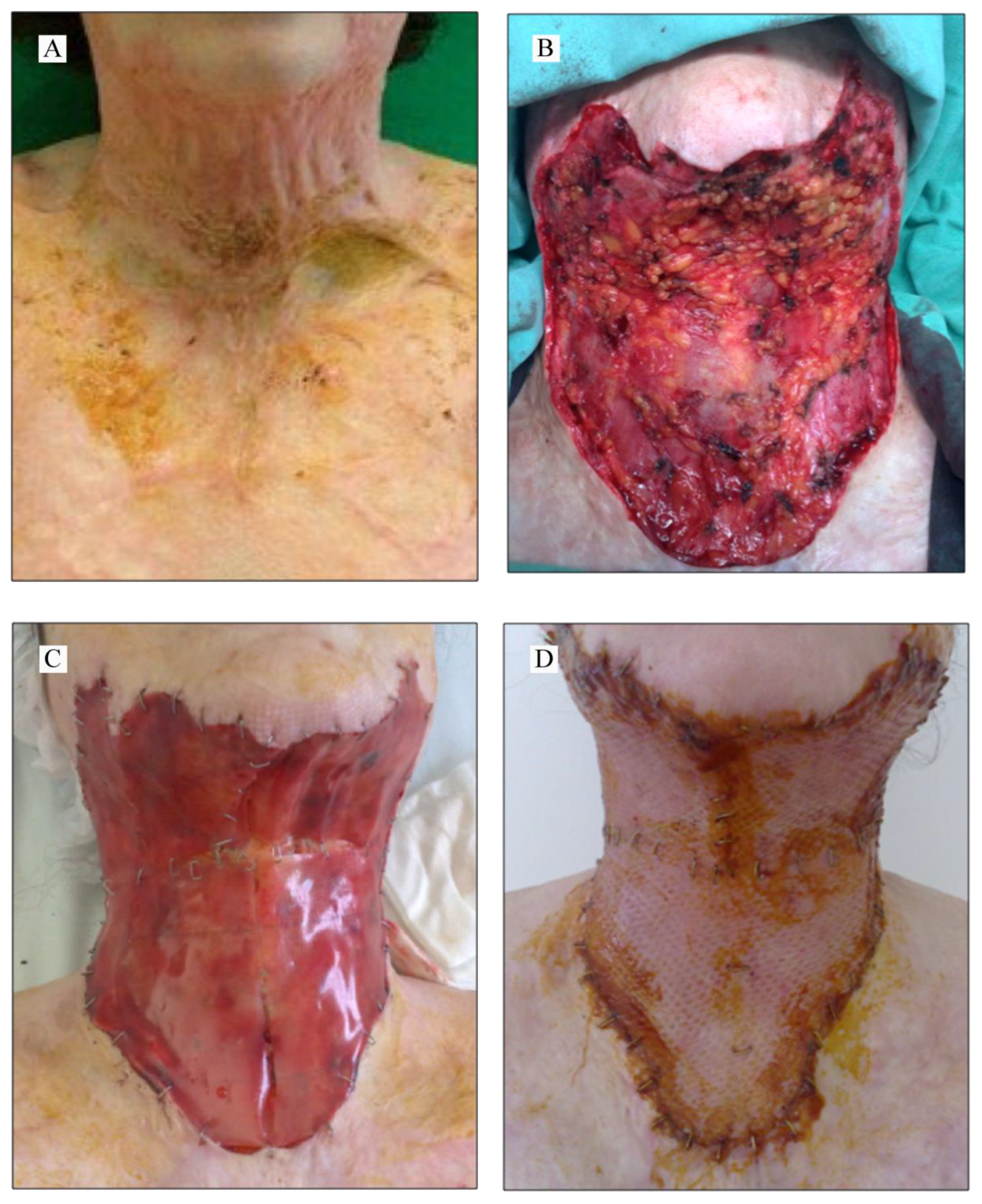 Applsci 10 03731 g001a