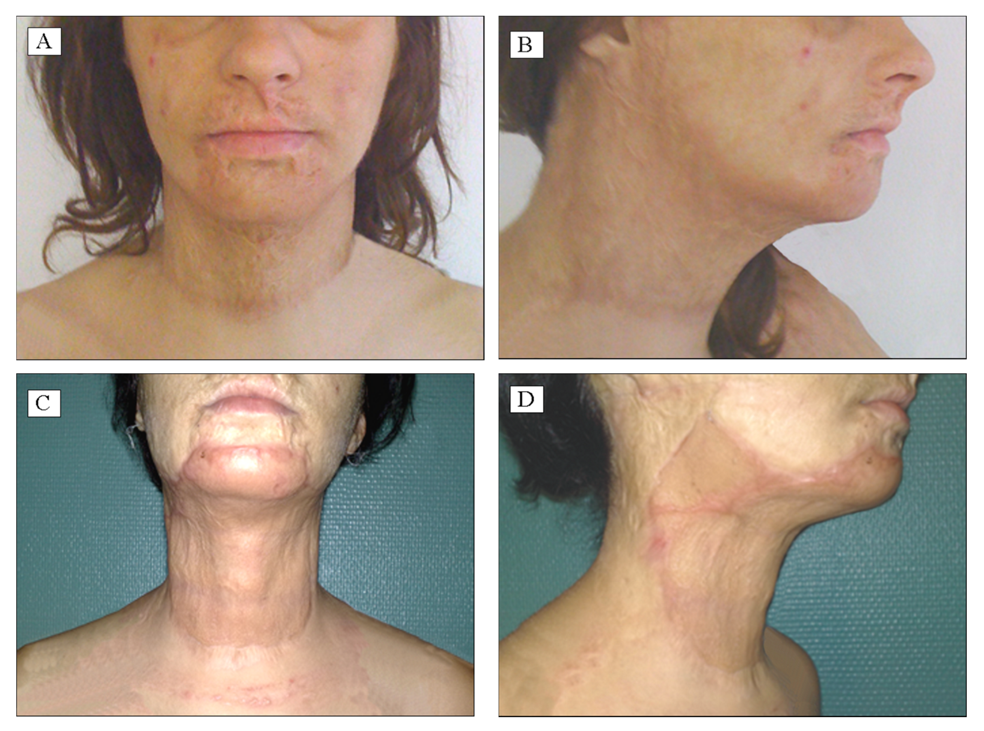 Applsci 10 03731 g003