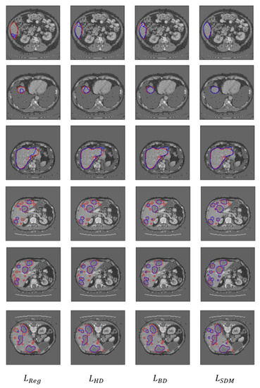 applied sciences free full text 3d liver and tumor segmentation with cnns based on region and distance metrics