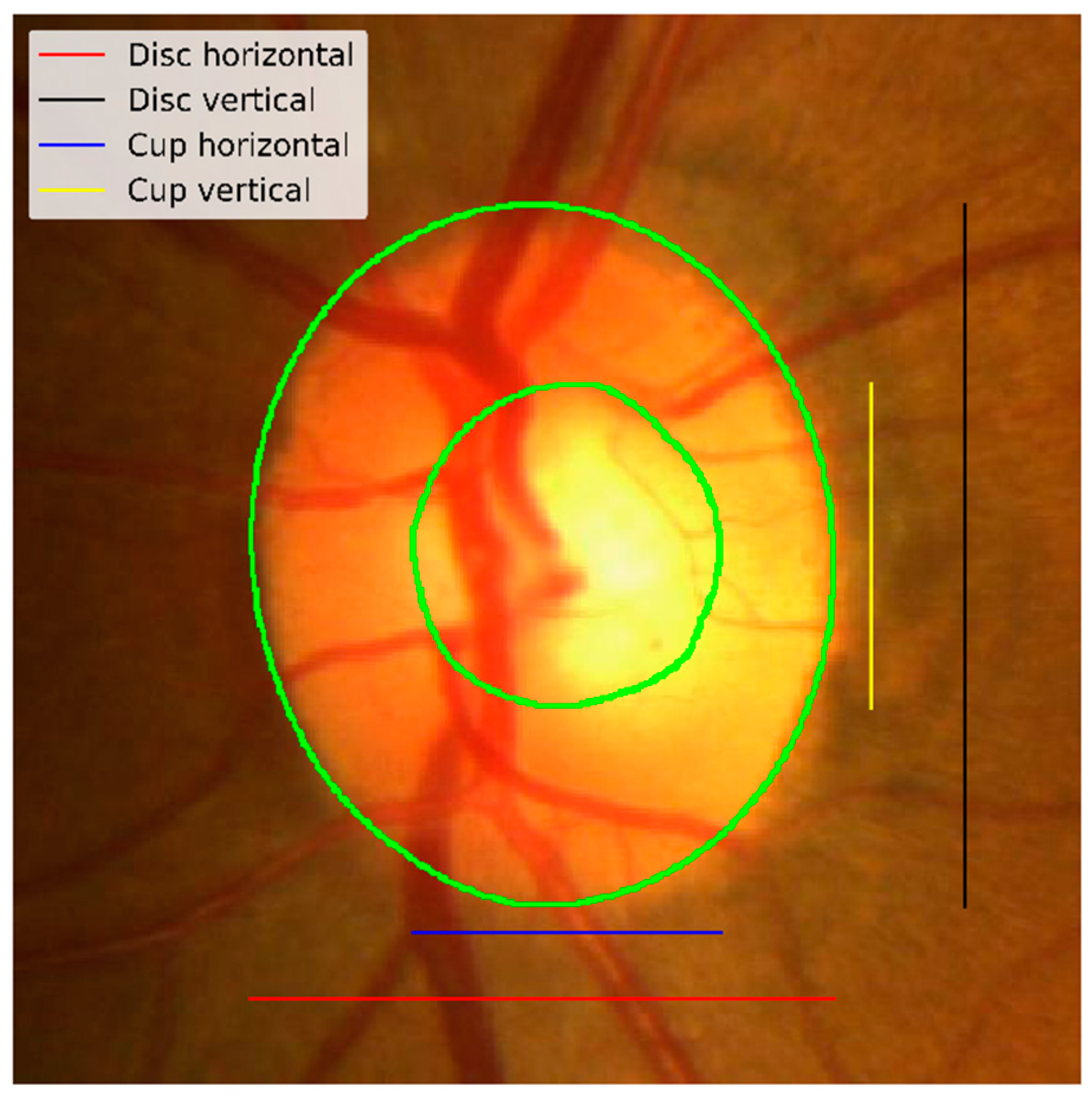 Applsci 10 03833 g005