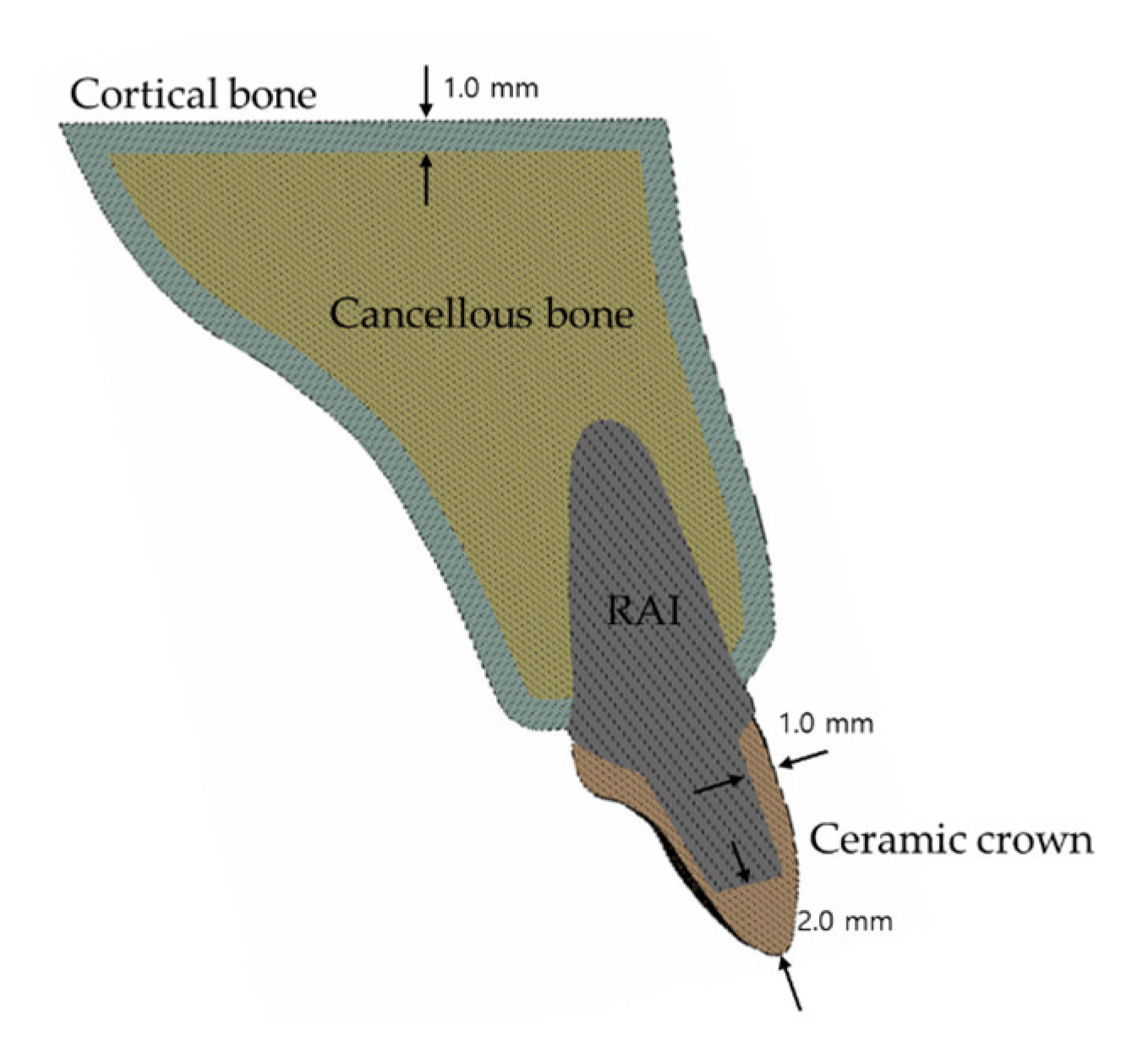 Applsci 10 04104 g002 Applsci 10 04104 g002