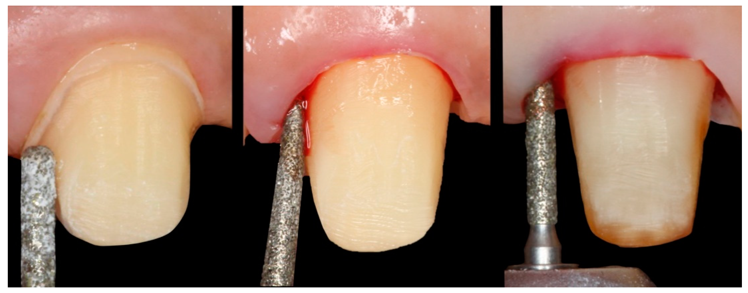 Applsci 10 04108 g001