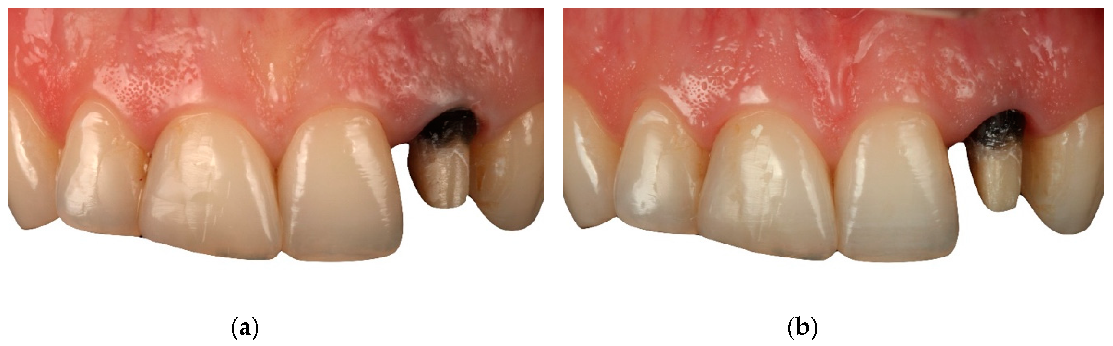 Applsci 10 04108 g002