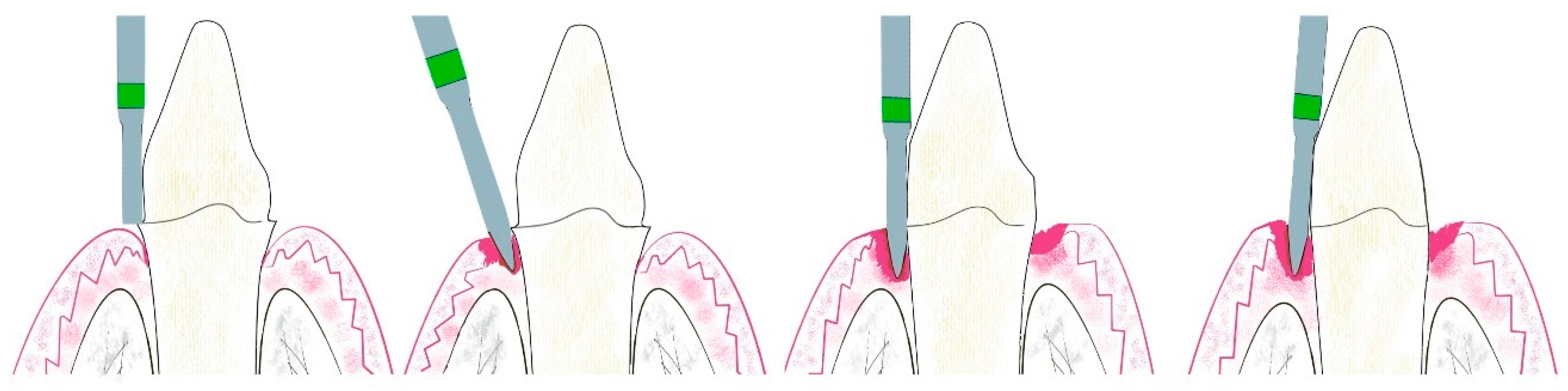 Applsci 10 04108 g003
