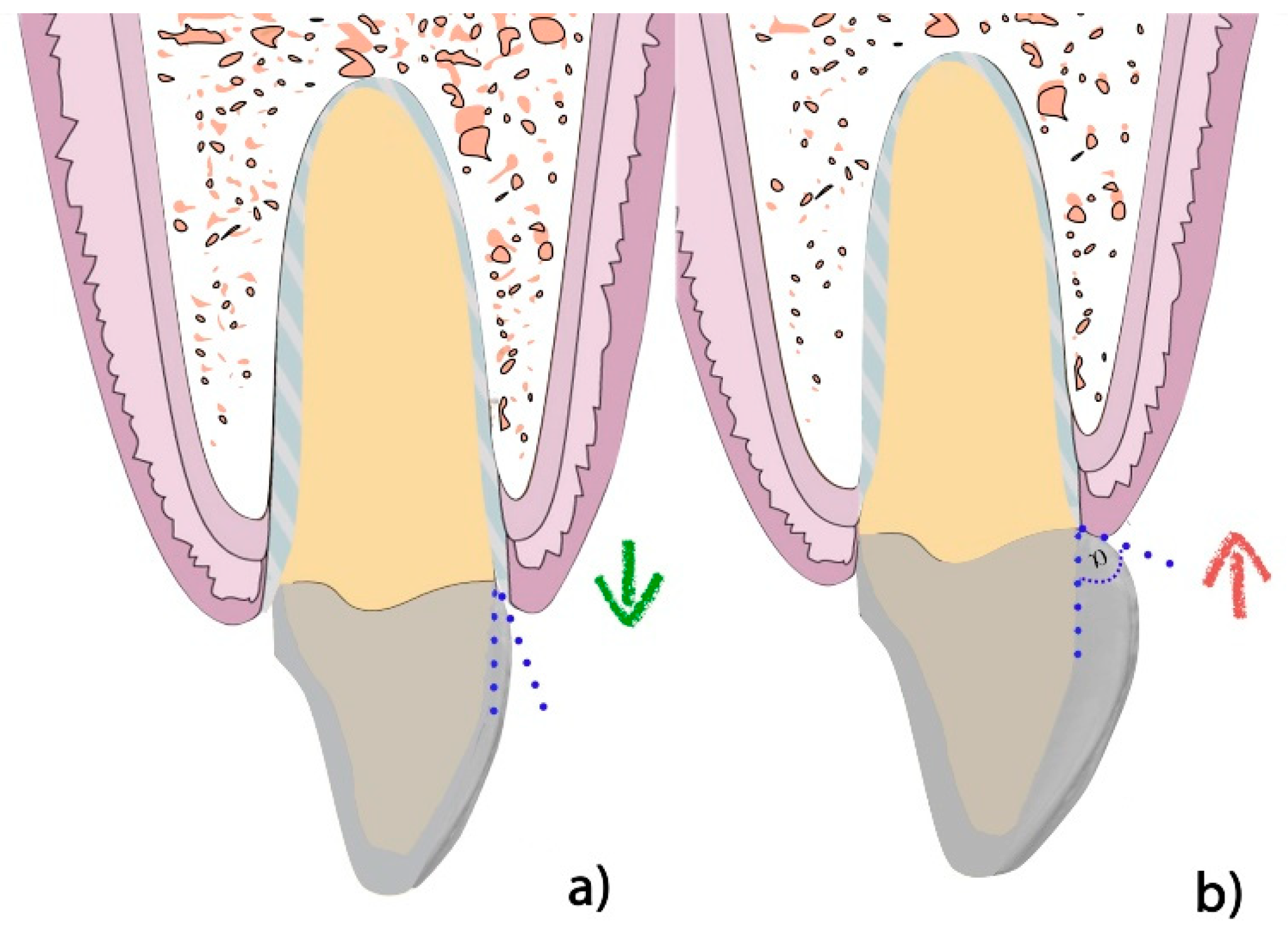 Applsci 10 04108 g004