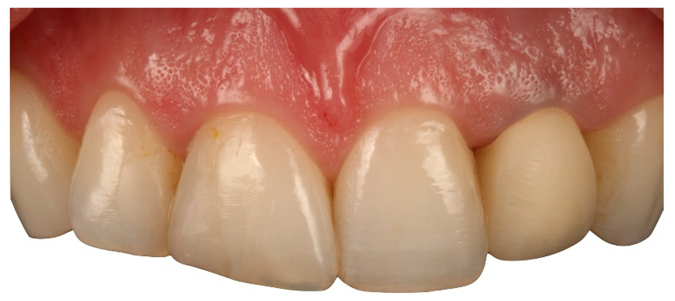 Applsci 10 04108 g005