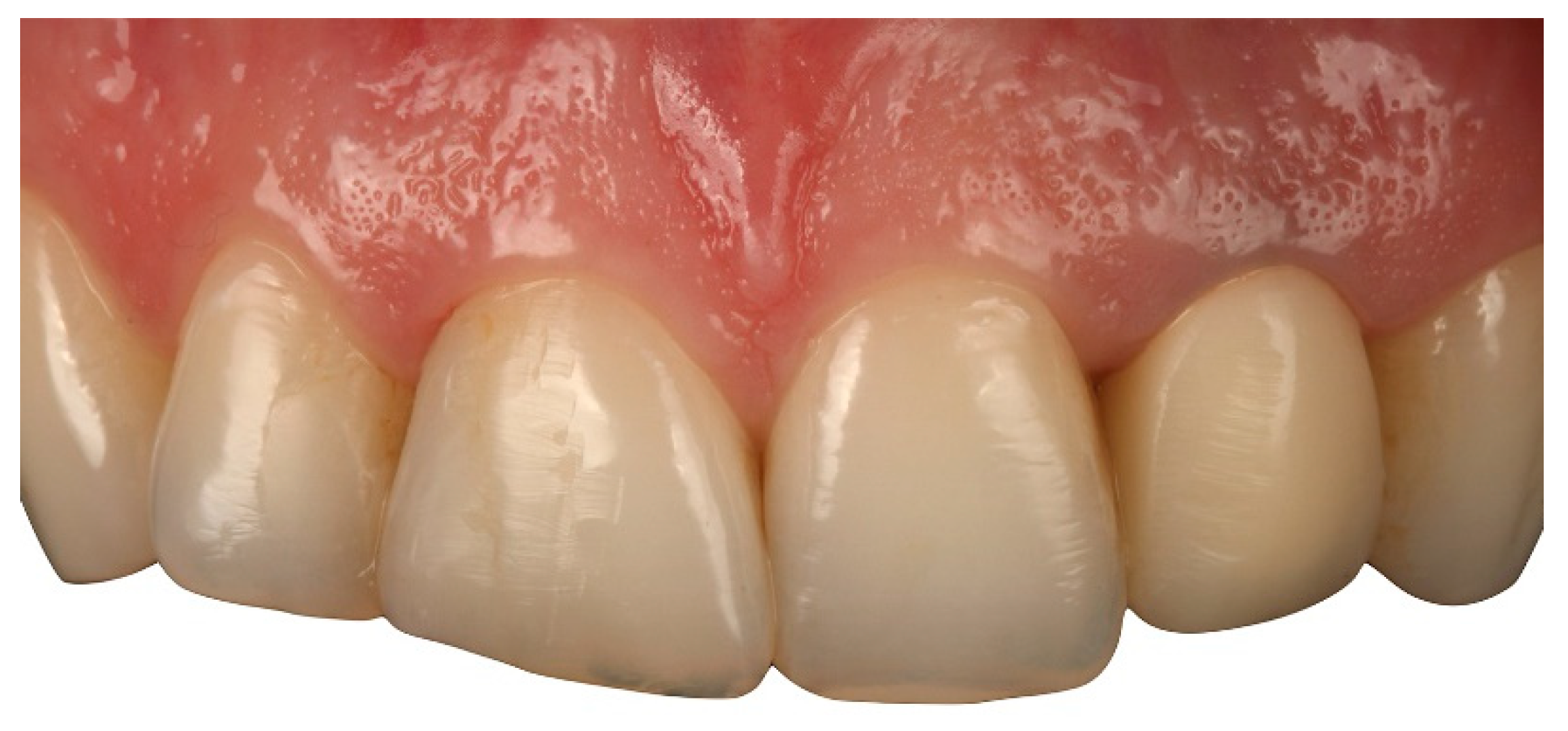 Applsci 10 04108 g006