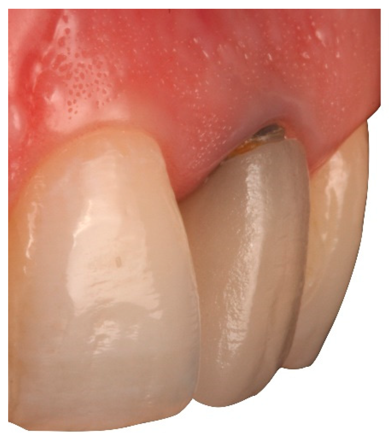 Applsci 10 04108 g017