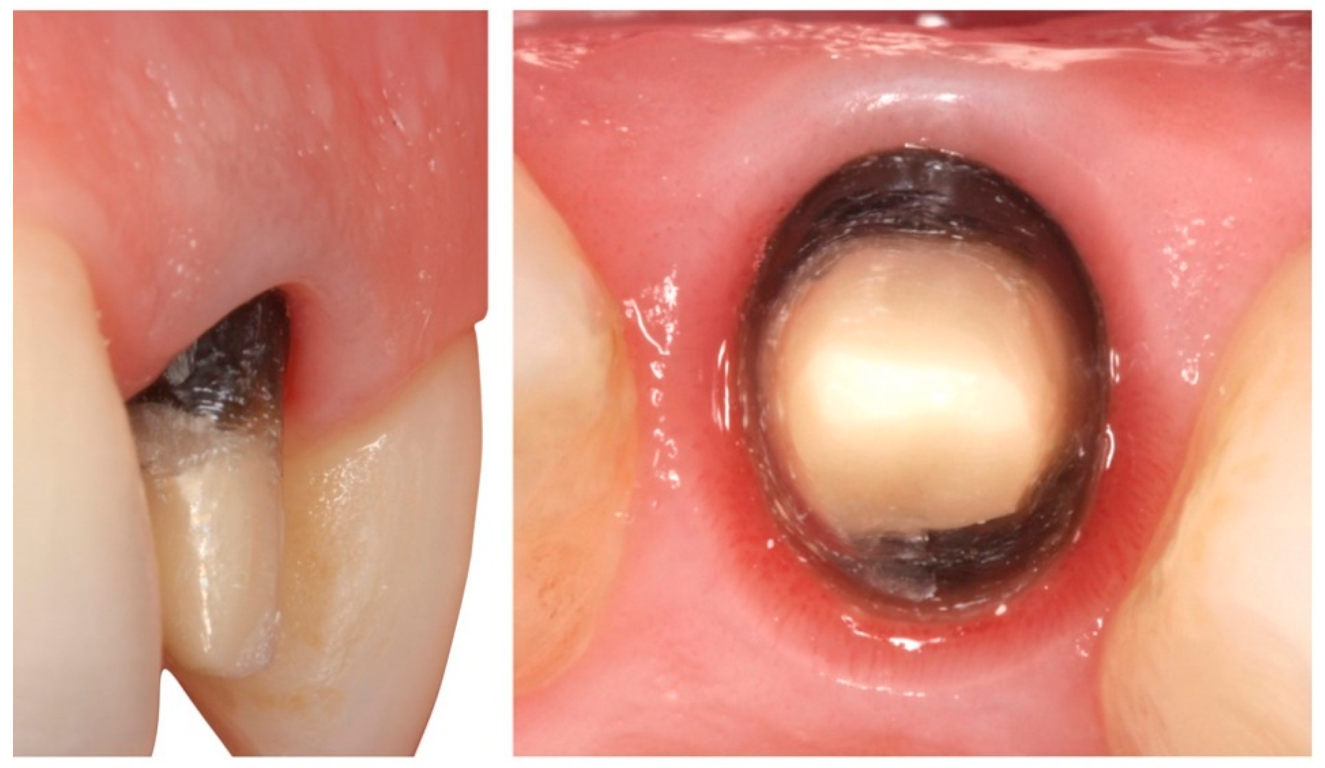 Applsci 10 04108 g018