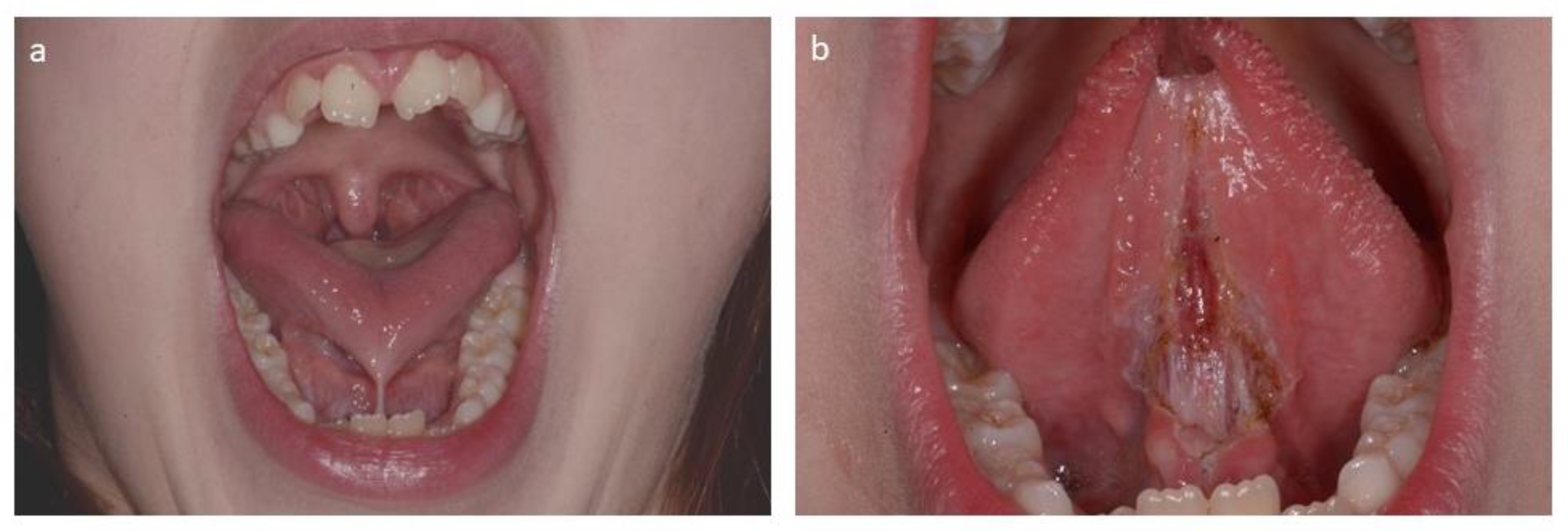 Applsci 10 04114 g002