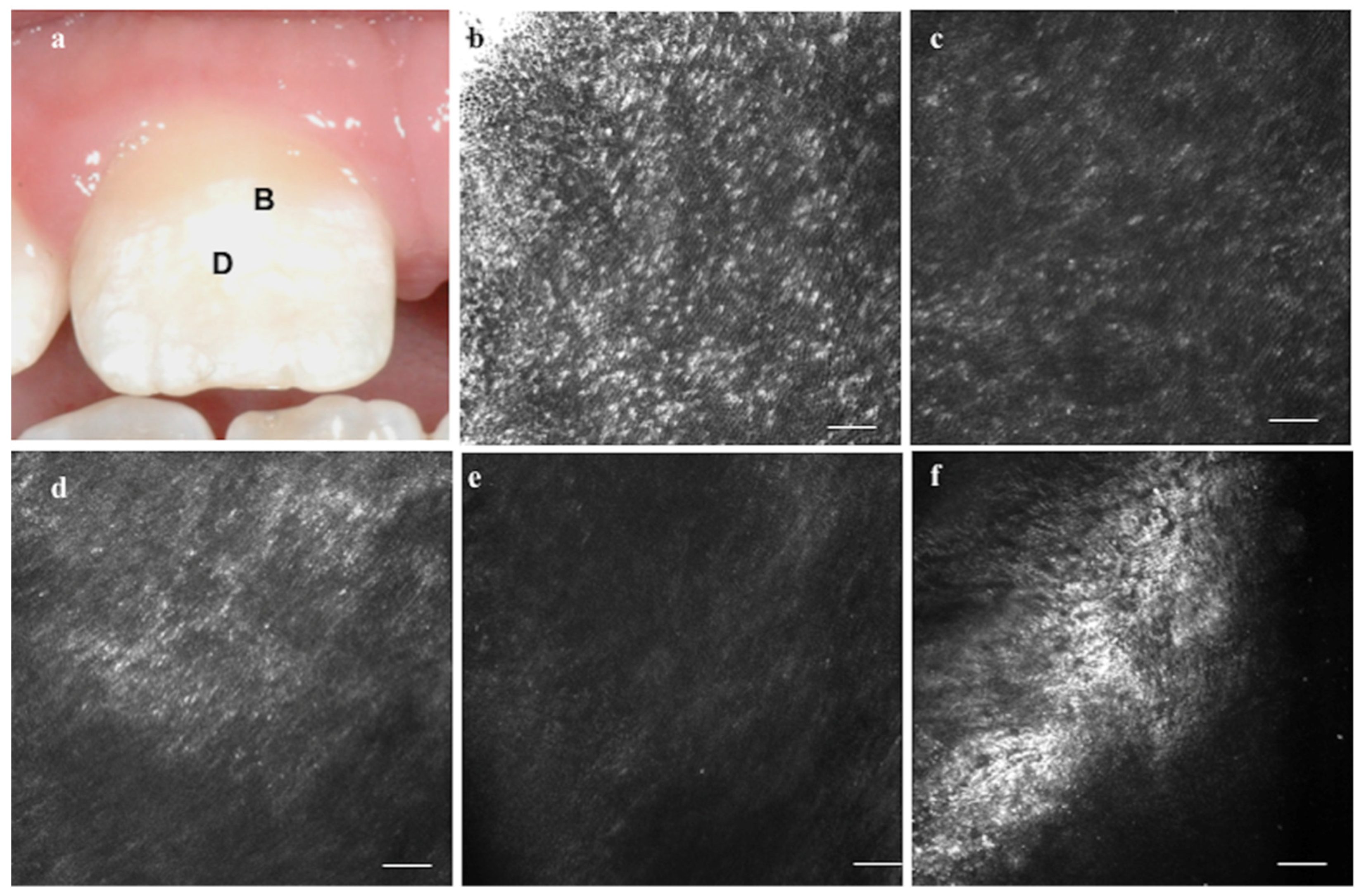 Applsci 10 04155 g001