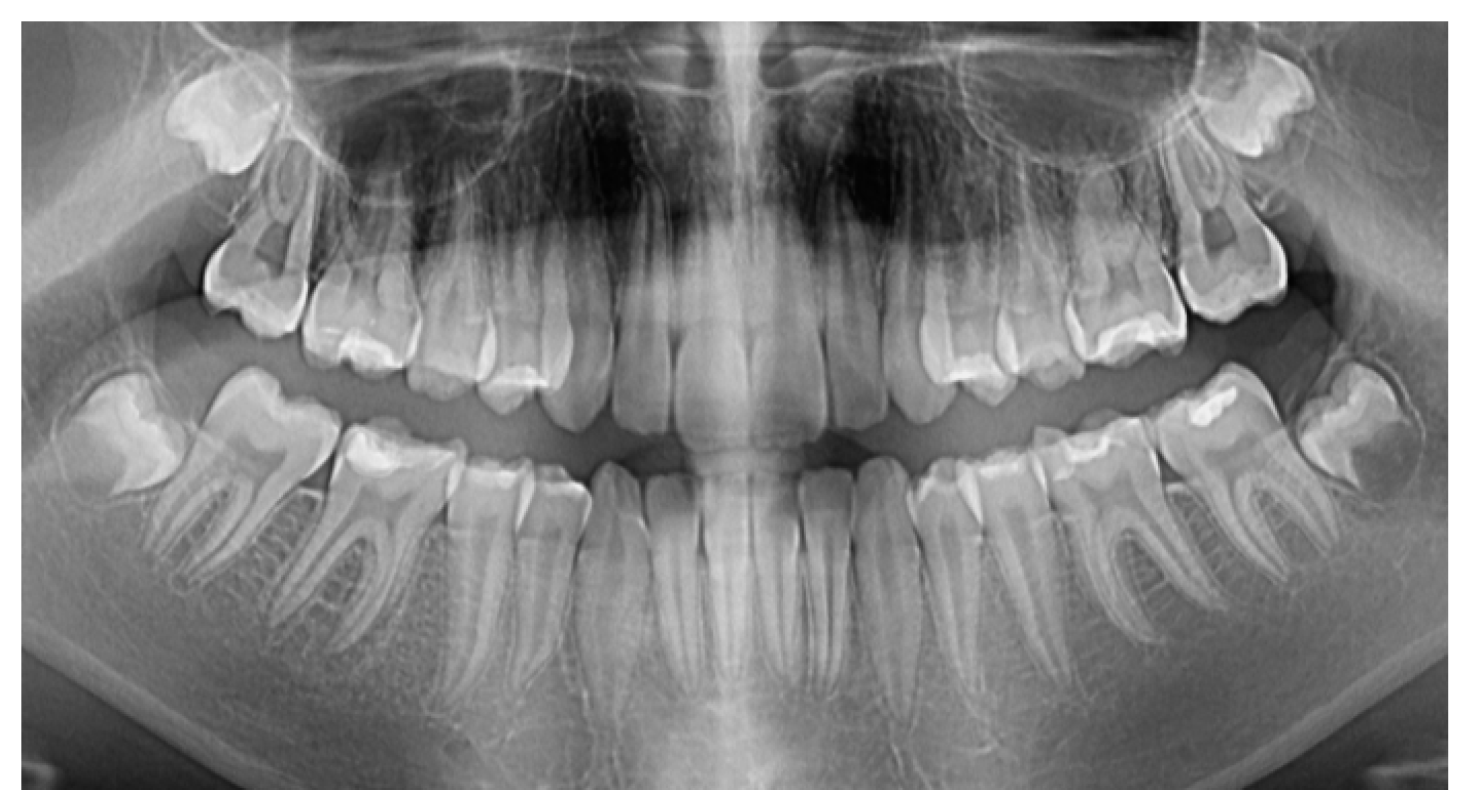 Applsci 10 04203 g002