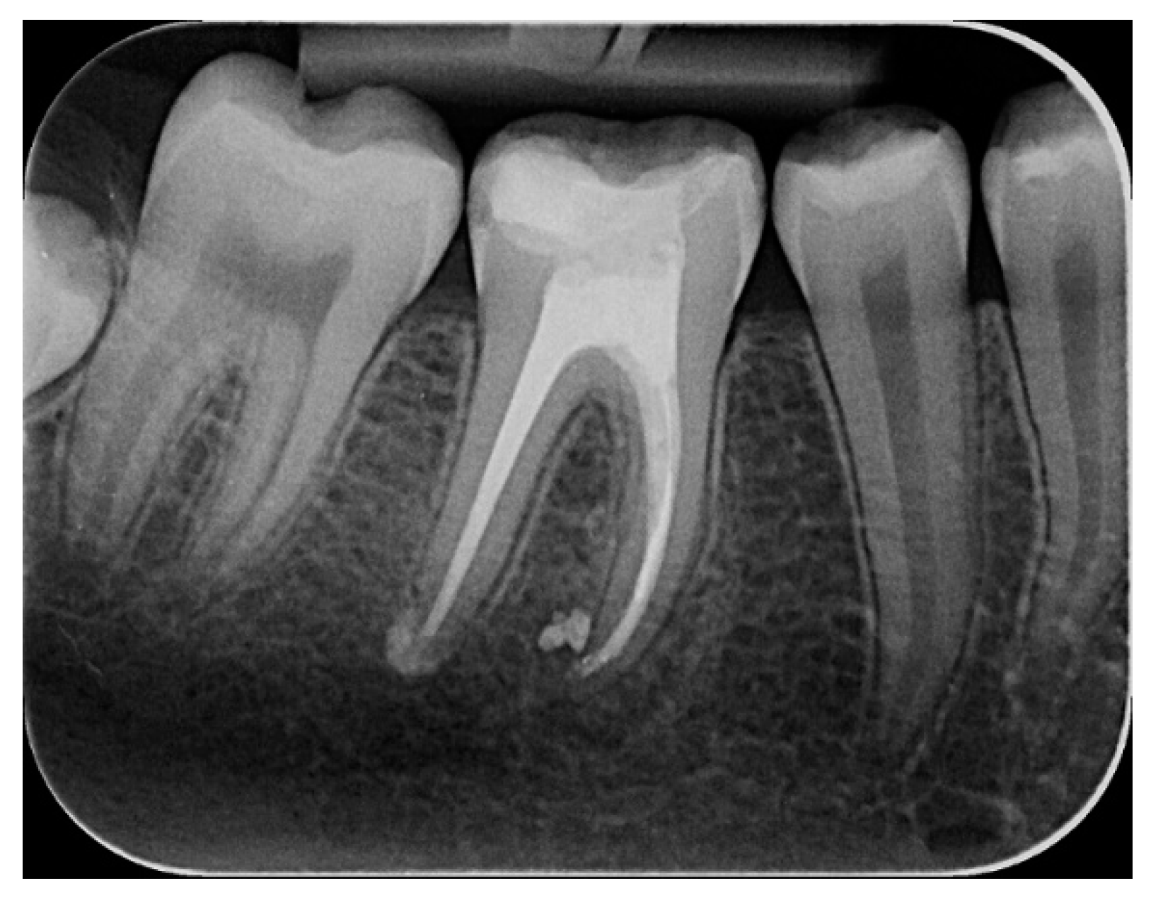 Applsci 10 04203 g004