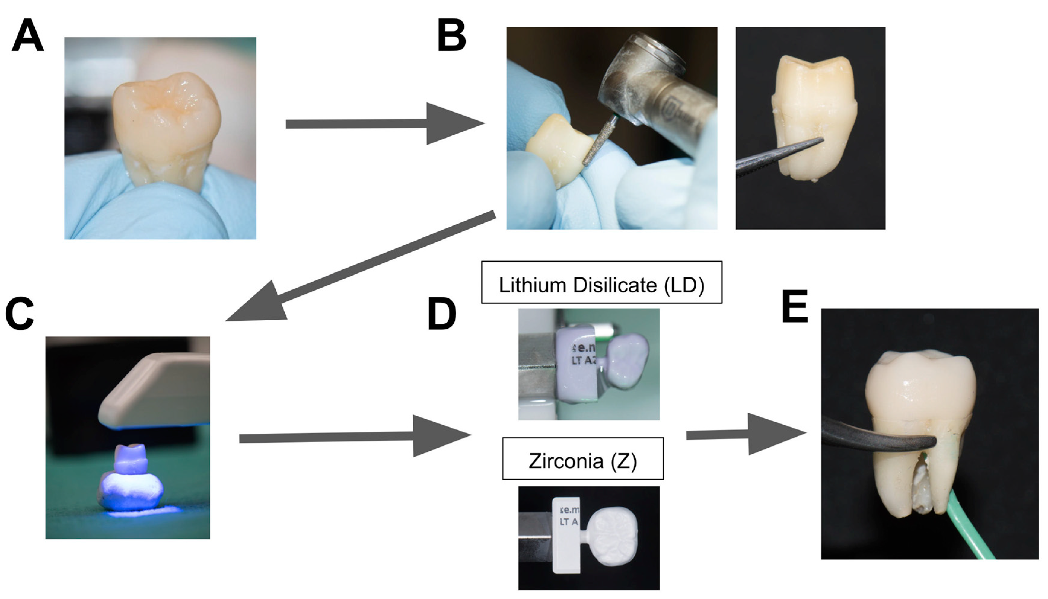 Applied Sciences Free FullText Utilization of ErYAG Laser in