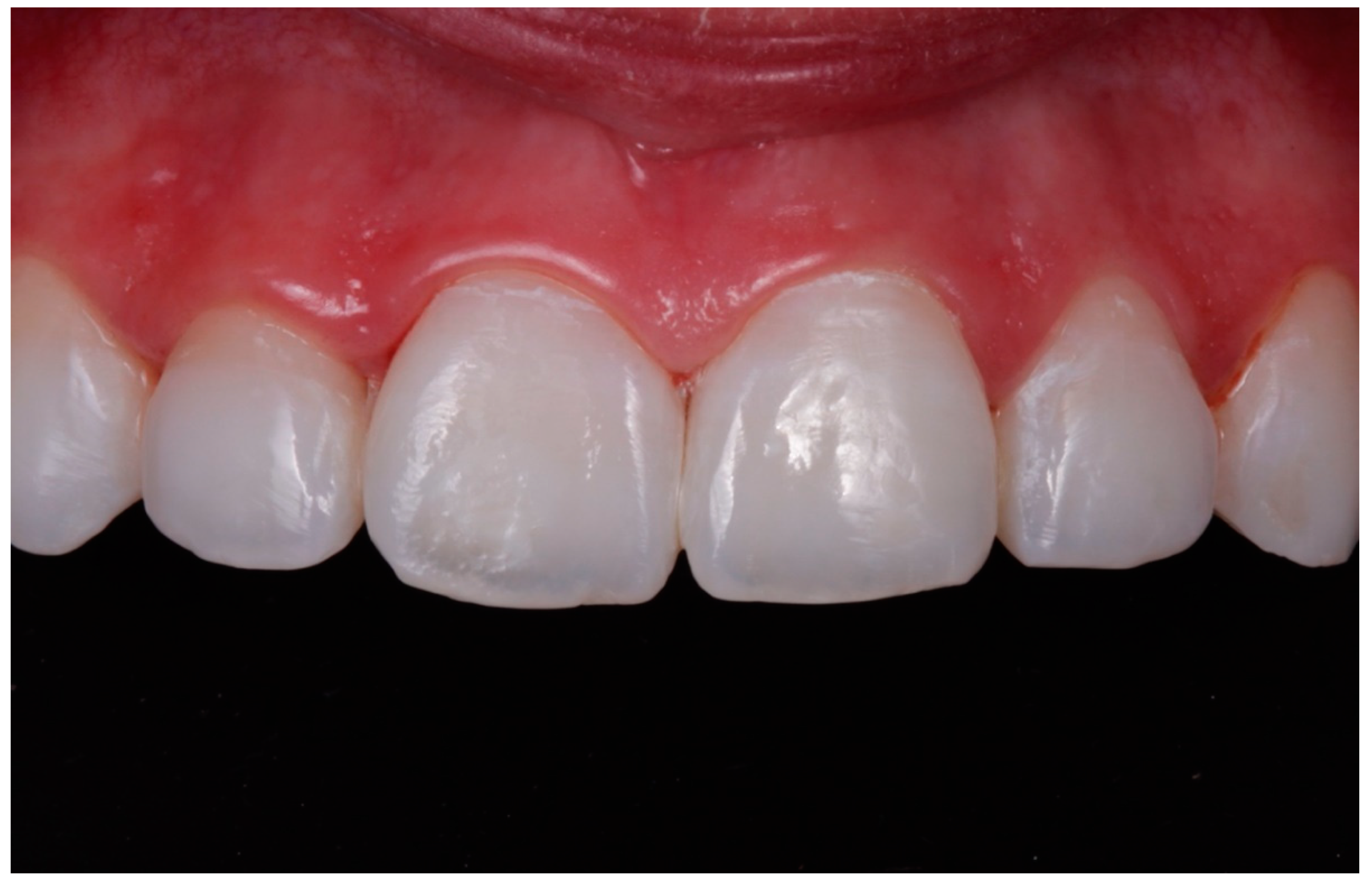 Applsci 10 04369 g003