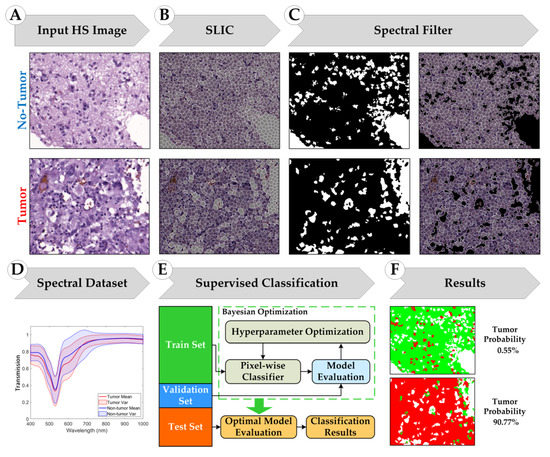 Hyperspectral Superpixel-Wise Glioblastoma Tumor Detection in ...