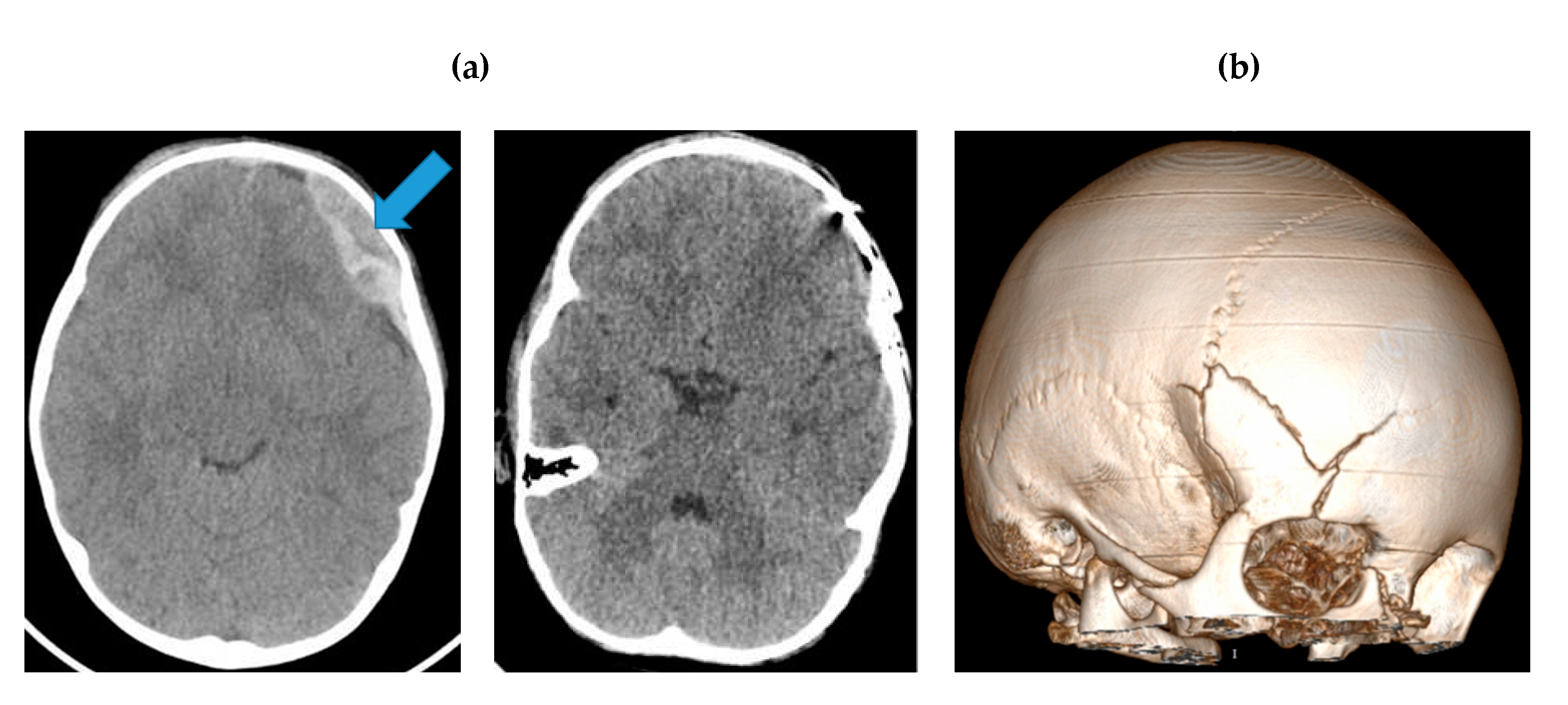 Applsci 10 04467 g002