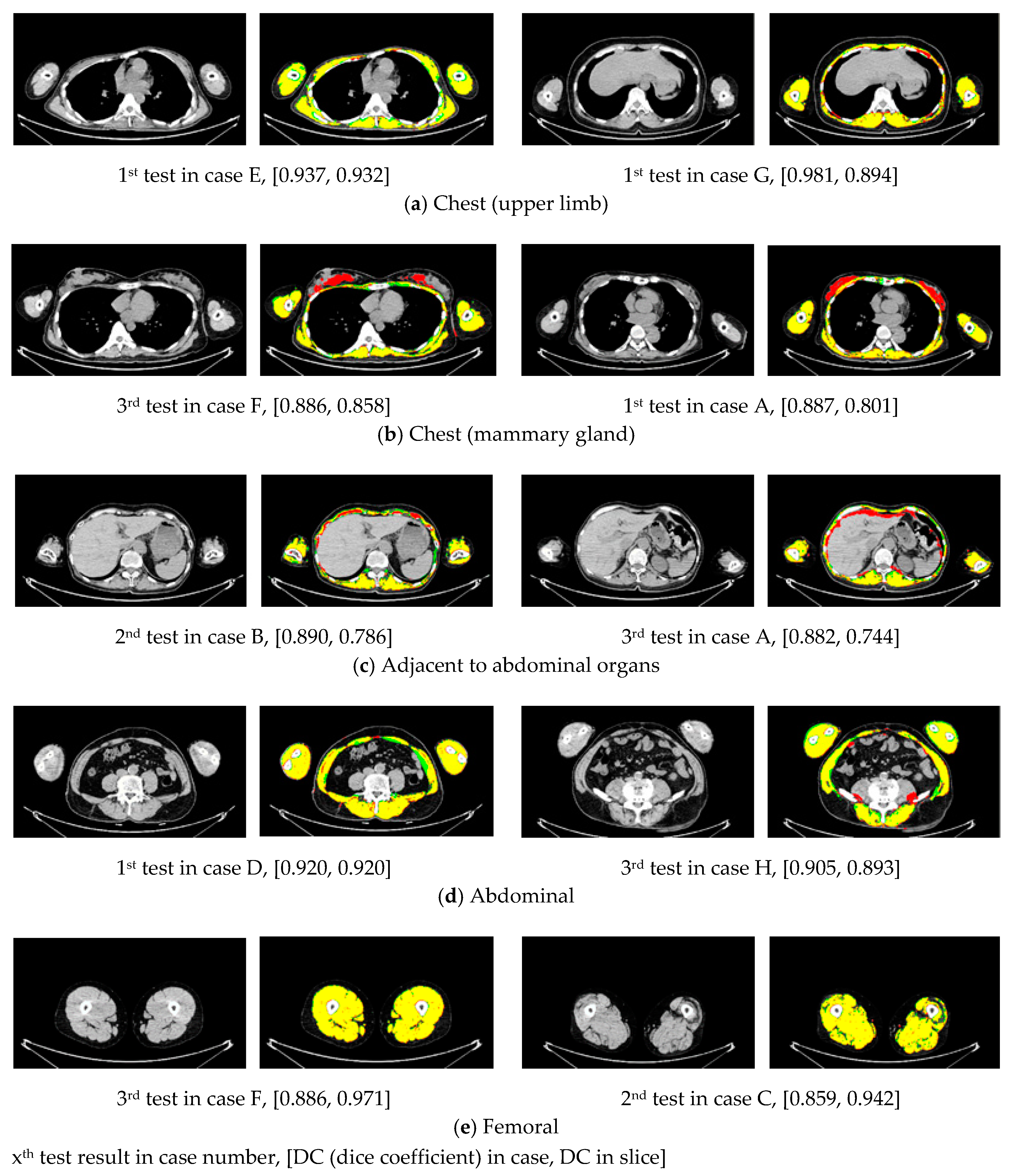 Applsci 10 04477 g004