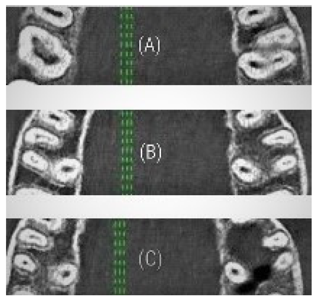 Applsci 10 04495 g004 Applsci 10 04495 g004