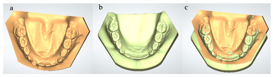 Three-Dimensional Evaluation of Slow Maxillary Expansion with Leaf ...