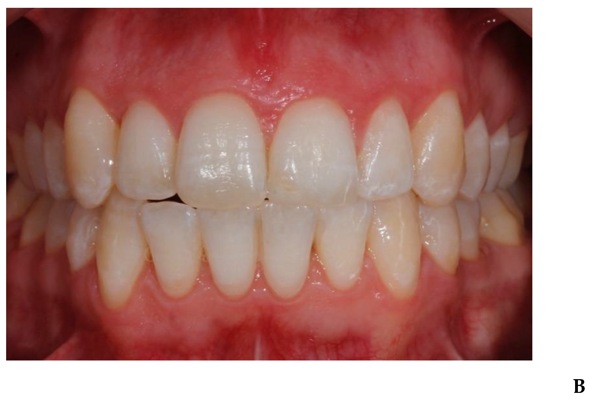 Applsci 10 04650 g003b Applsci 10 04650 g003b