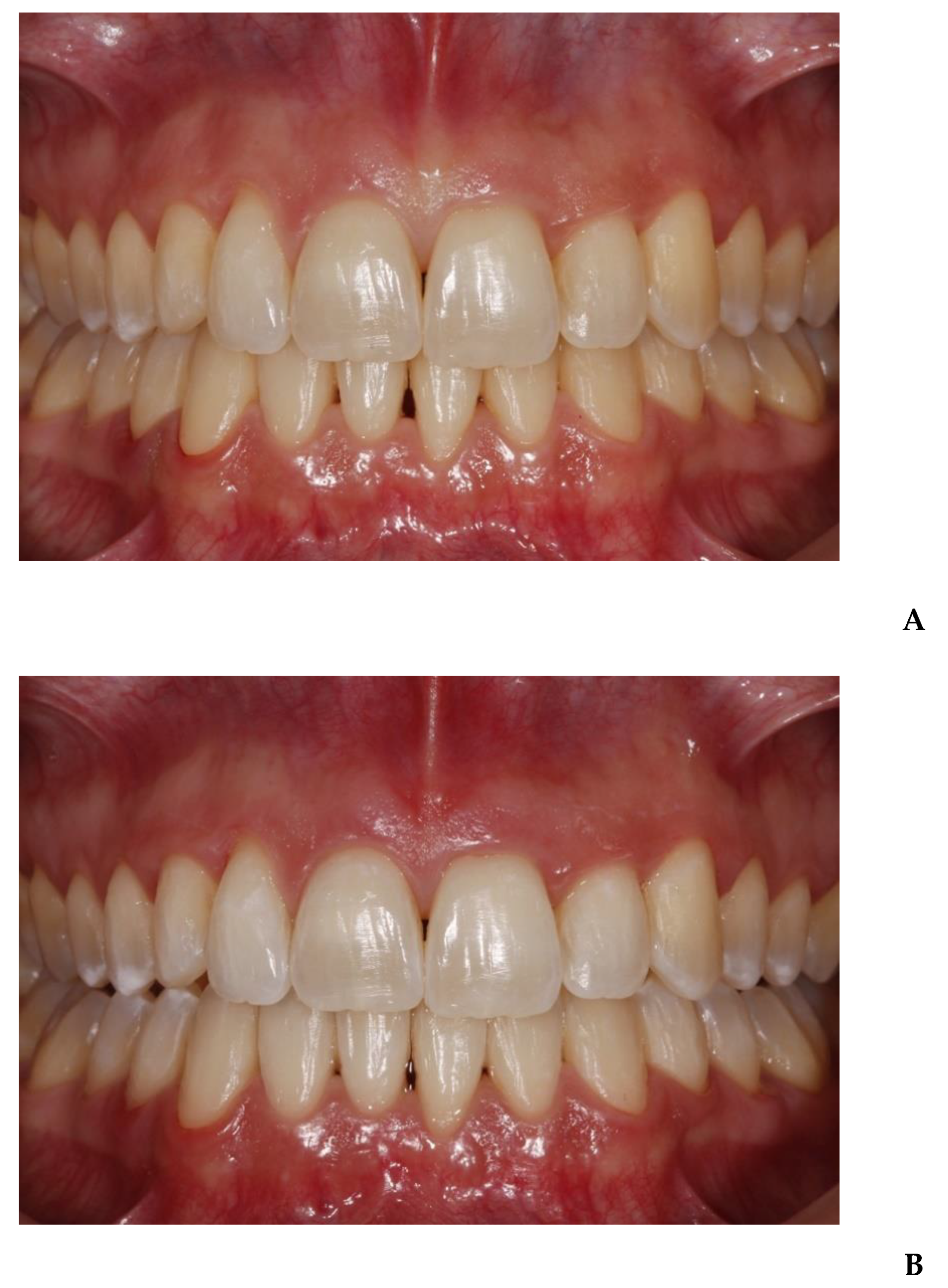 Applsci 10 04650 g004 Applsci 10 04650 g004