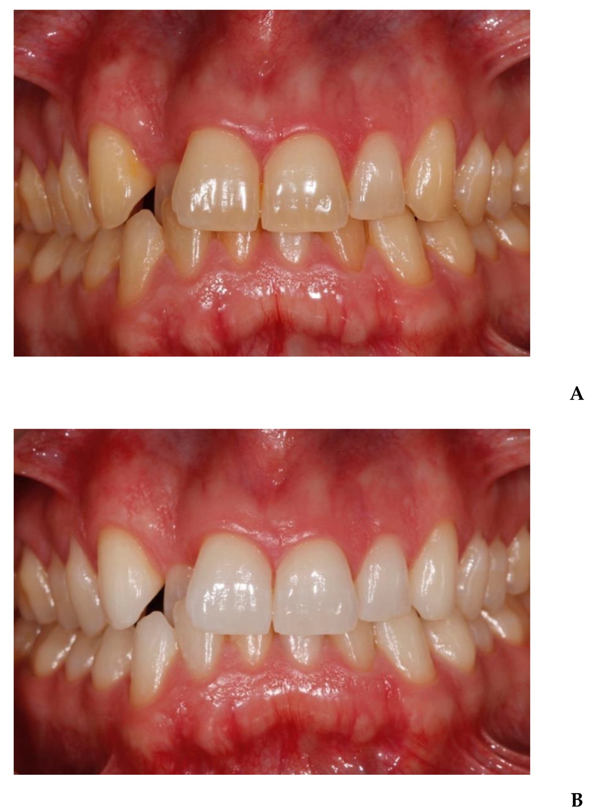 Applsci 10 04650 g005 Applsci 10 04650 g005