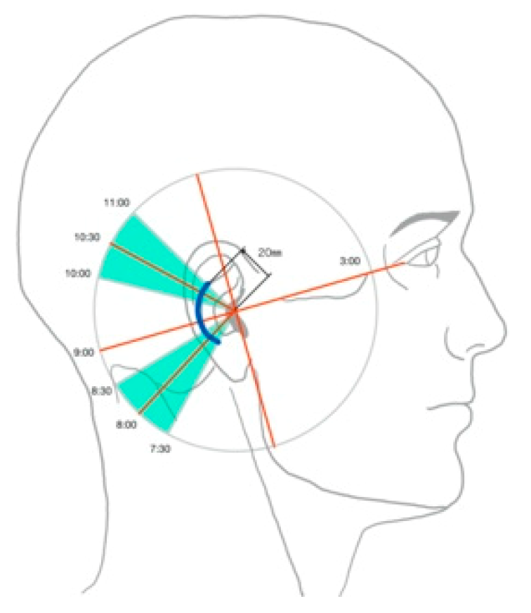 Applsci 10 04922 g004 Applsci 10 04922 g004