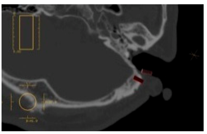 Applsci 10 04922 g013 Applsci 10 04922 g013