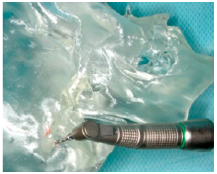 Applsci 10 04922 g022 Applsci 10 04922 g022