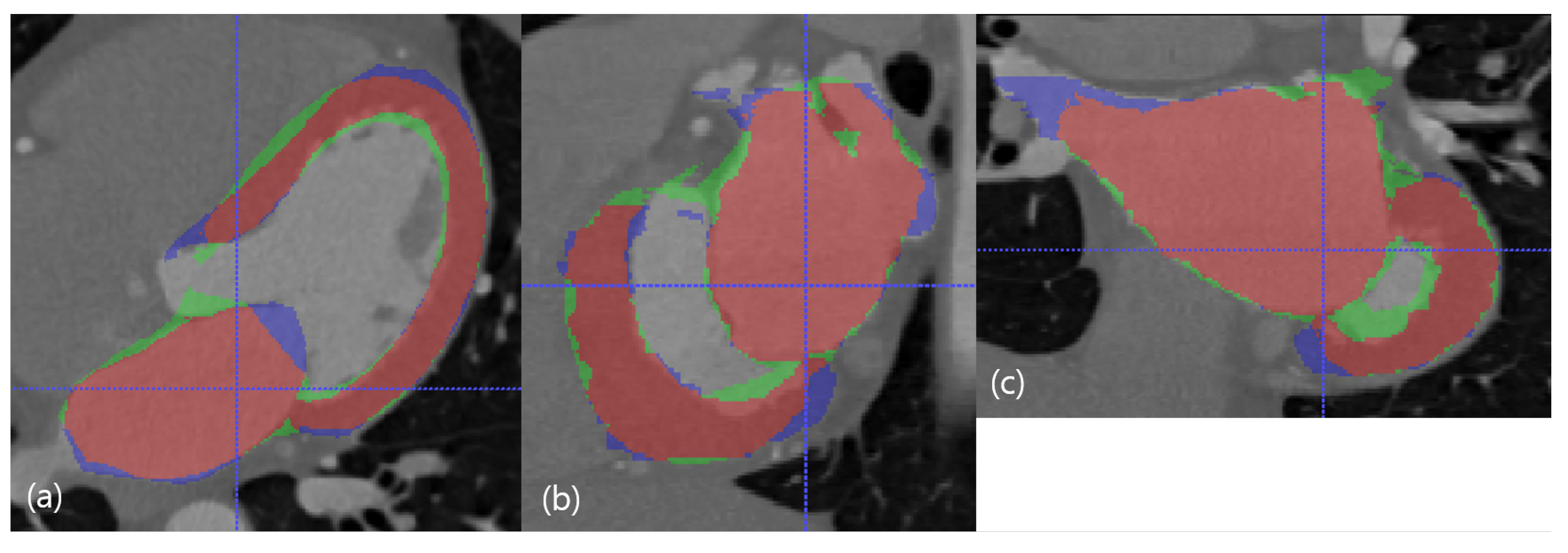 Applsci 10 04947 g005