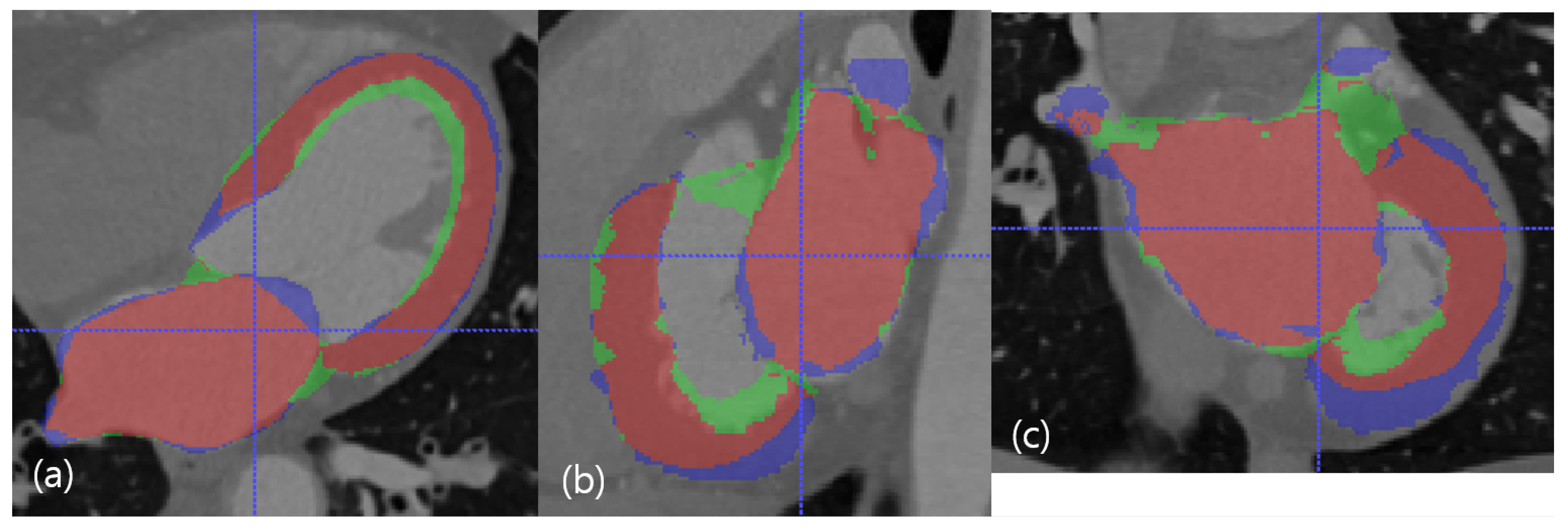 Applsci 10 04947 g006