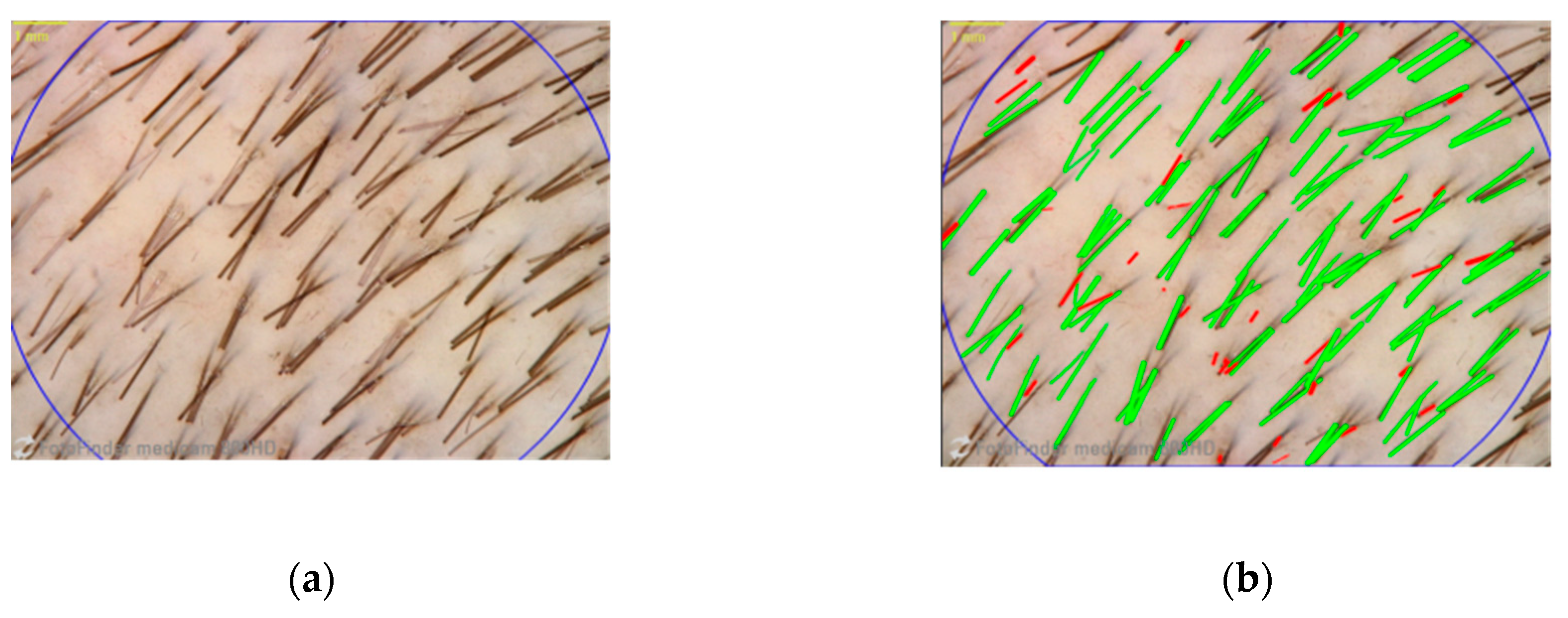 Applied Sciences | Free Full-Text | What Can Complex Dietary Supplements Do for Hair Loss and How Can It Be Validly Measured—A Review Applied Sciences | Free Full-Text | What Can Complex Dietary Supplements Do for Hair Loss and How Can It Be Validly Measured—A Review