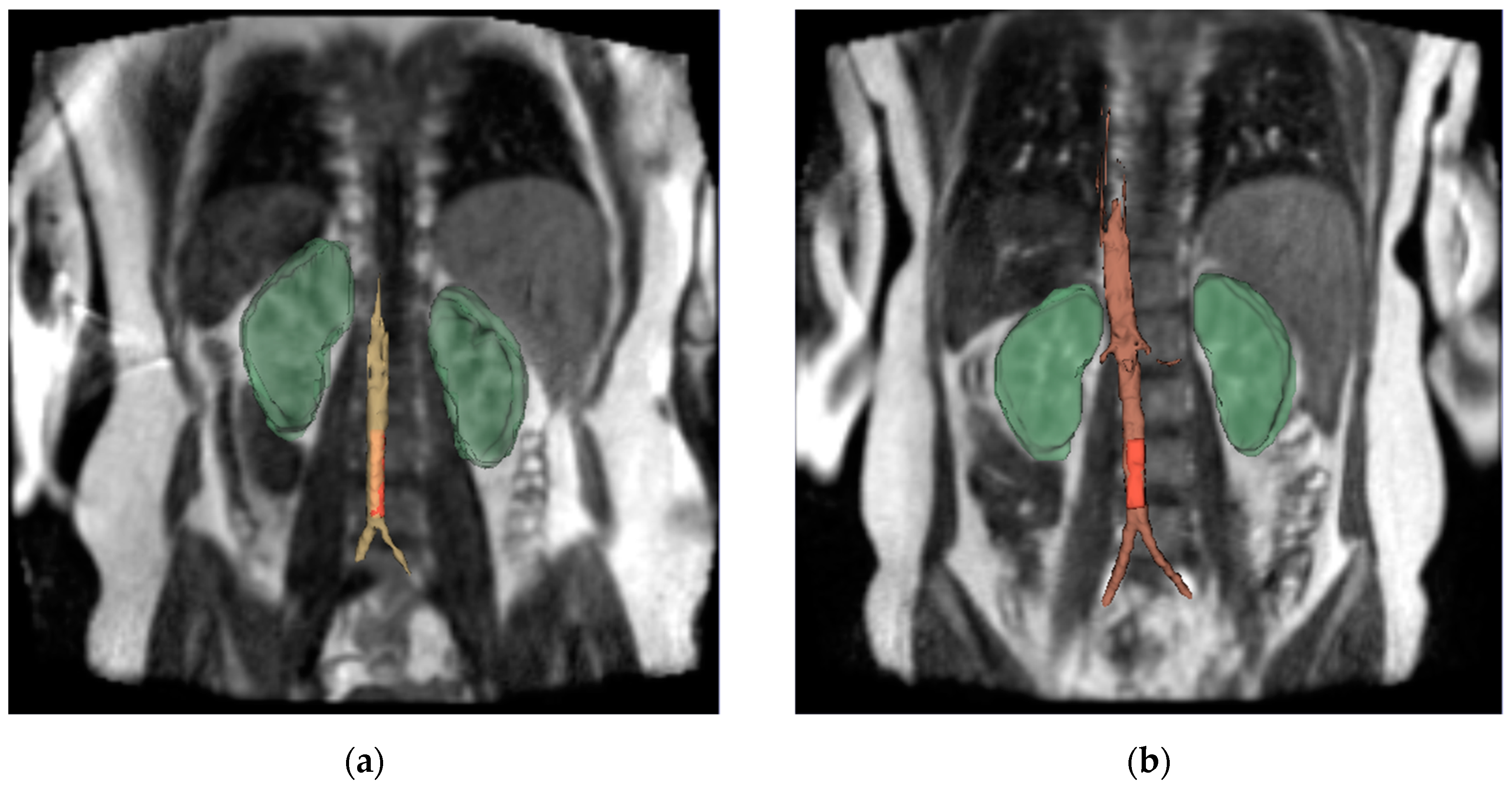 Applsci 10 05525 g004a Applsci 10 05525 g004a