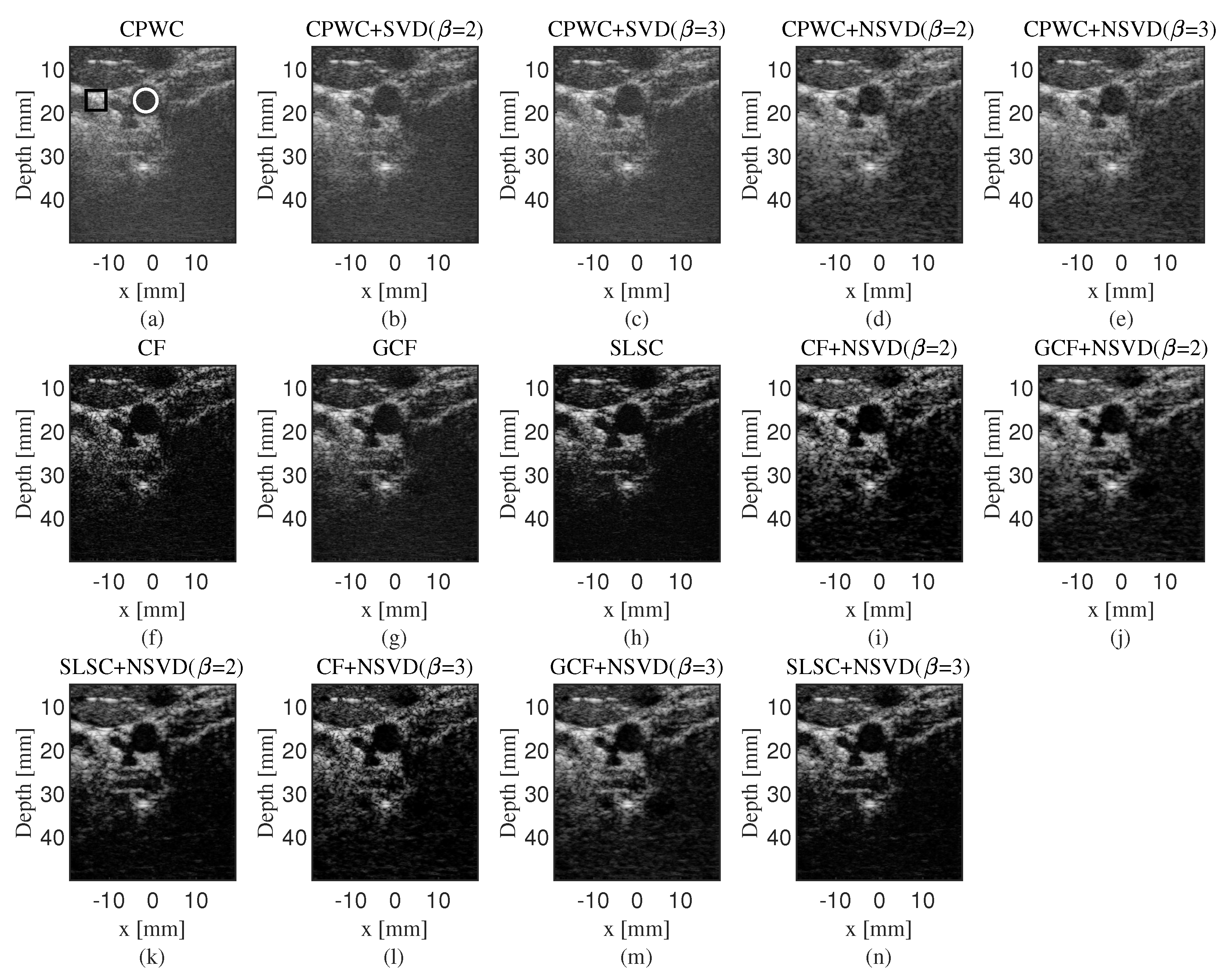 Applied Sciences Free Full Text Neighborhood Singular Value Decomposition Filter And Application In Adaptive Beamforming For Coherent Plane Wave Compounding Html
