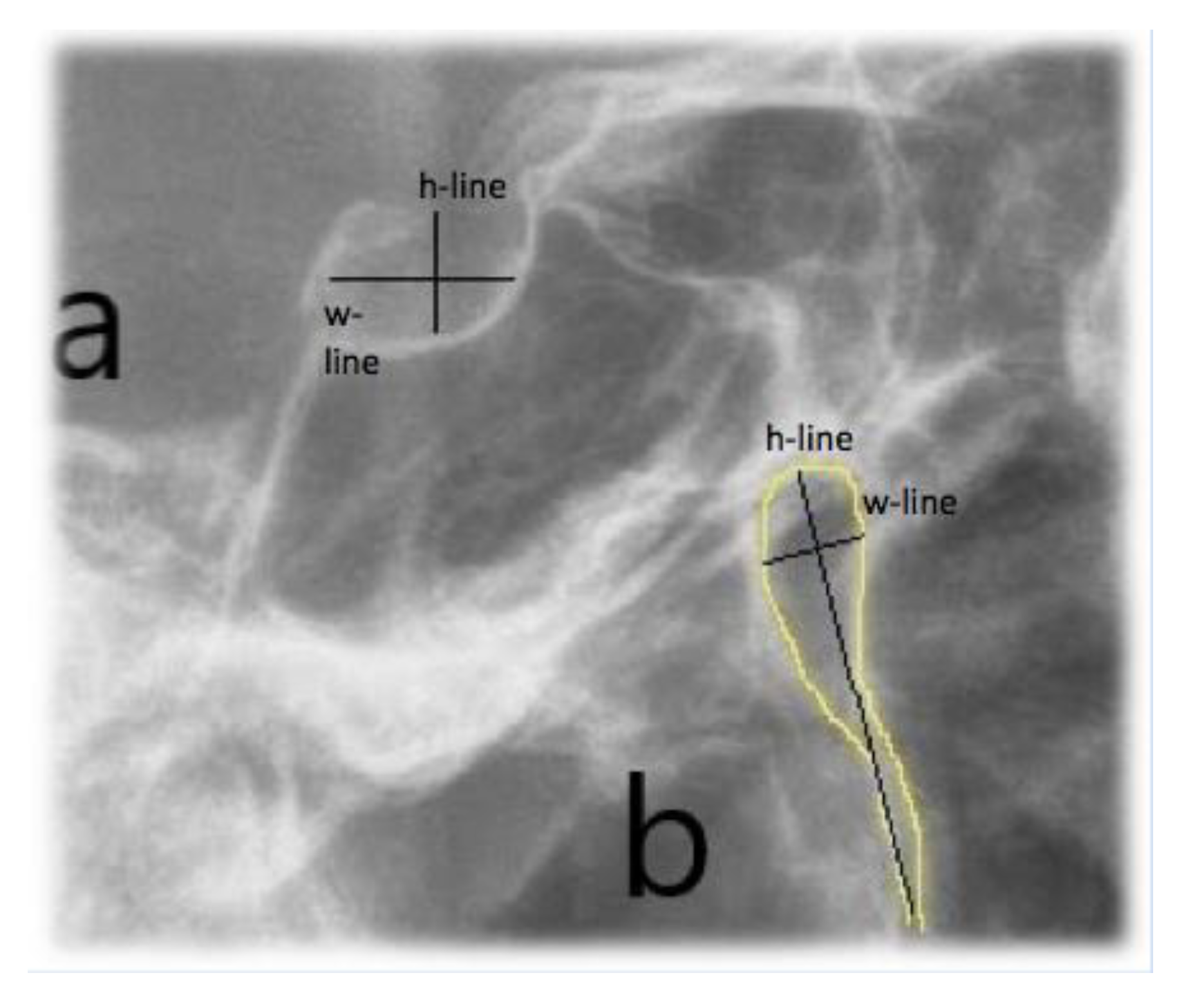 Applsci 10 05638 g004