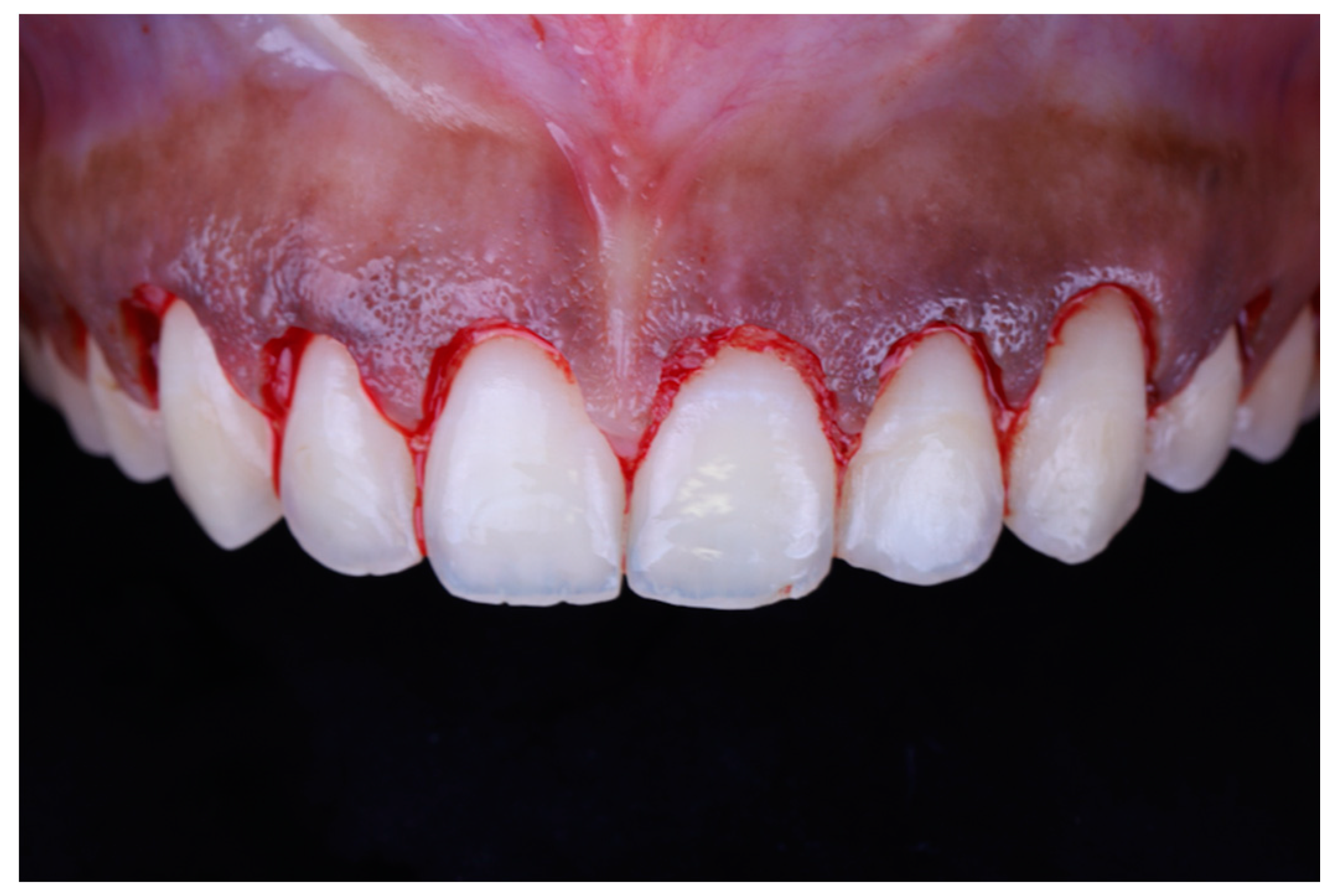 Applsci 10 05697 g006 550