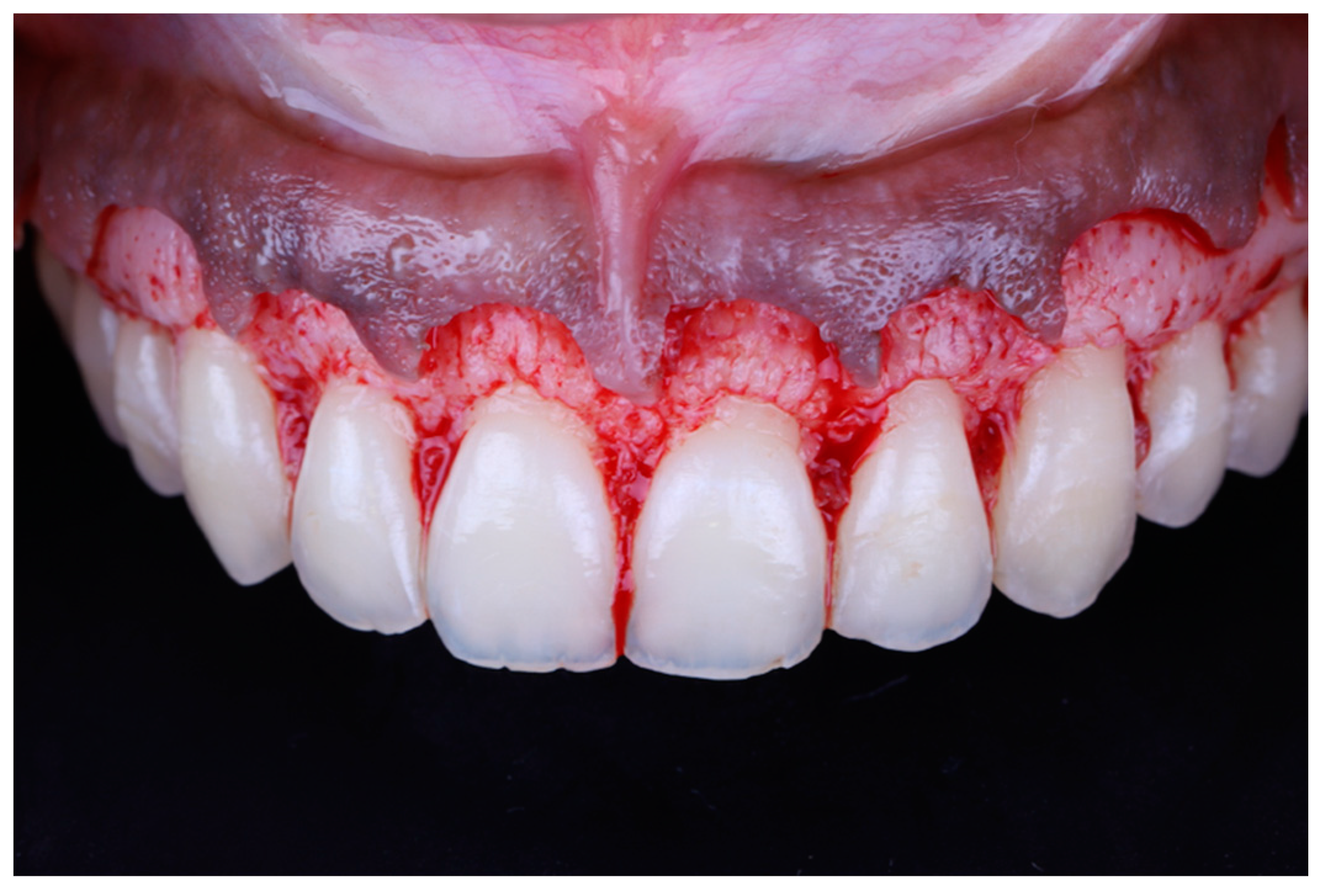 Applsci 10 05697 g007 550