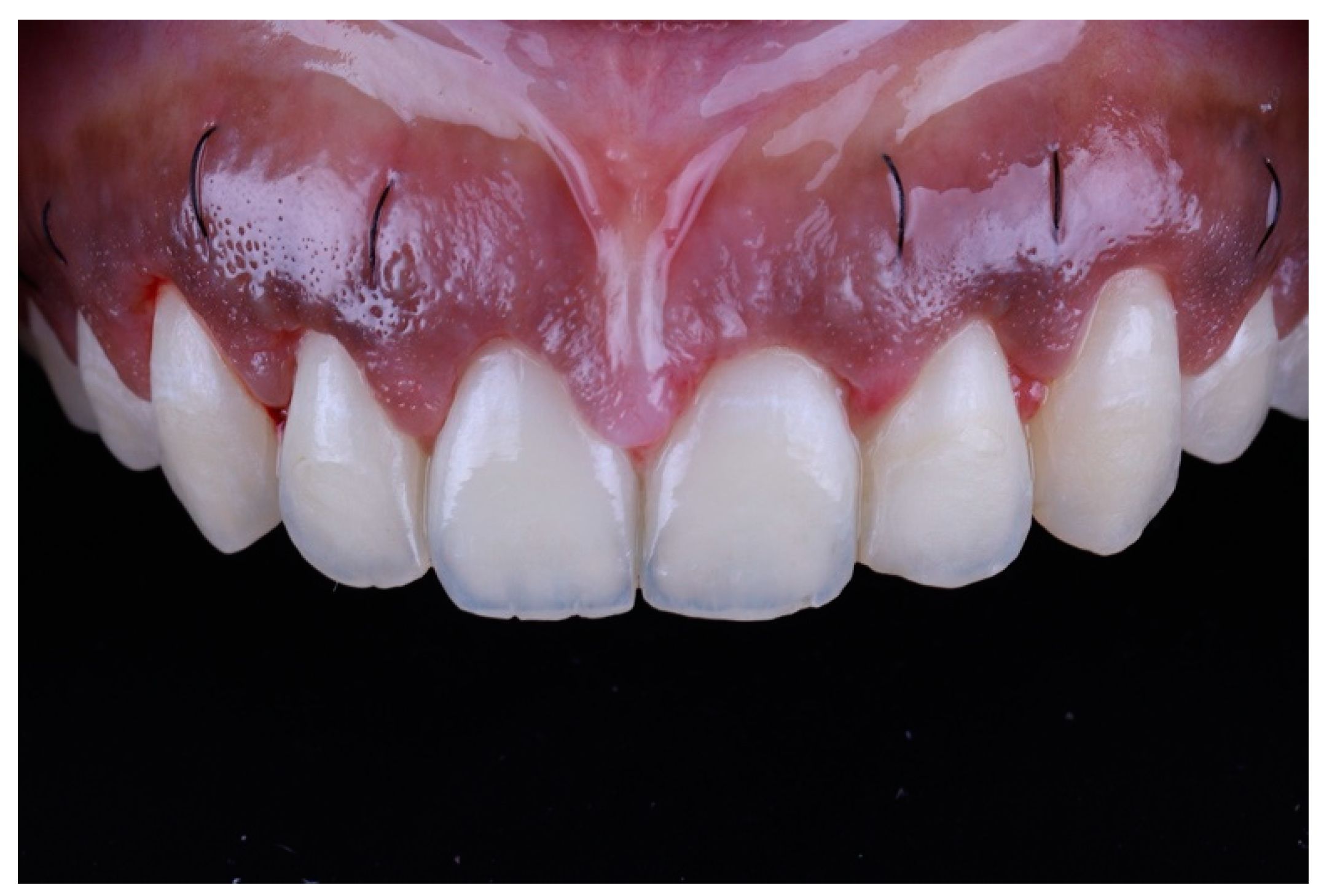 Applsci 10 05697 g010 550