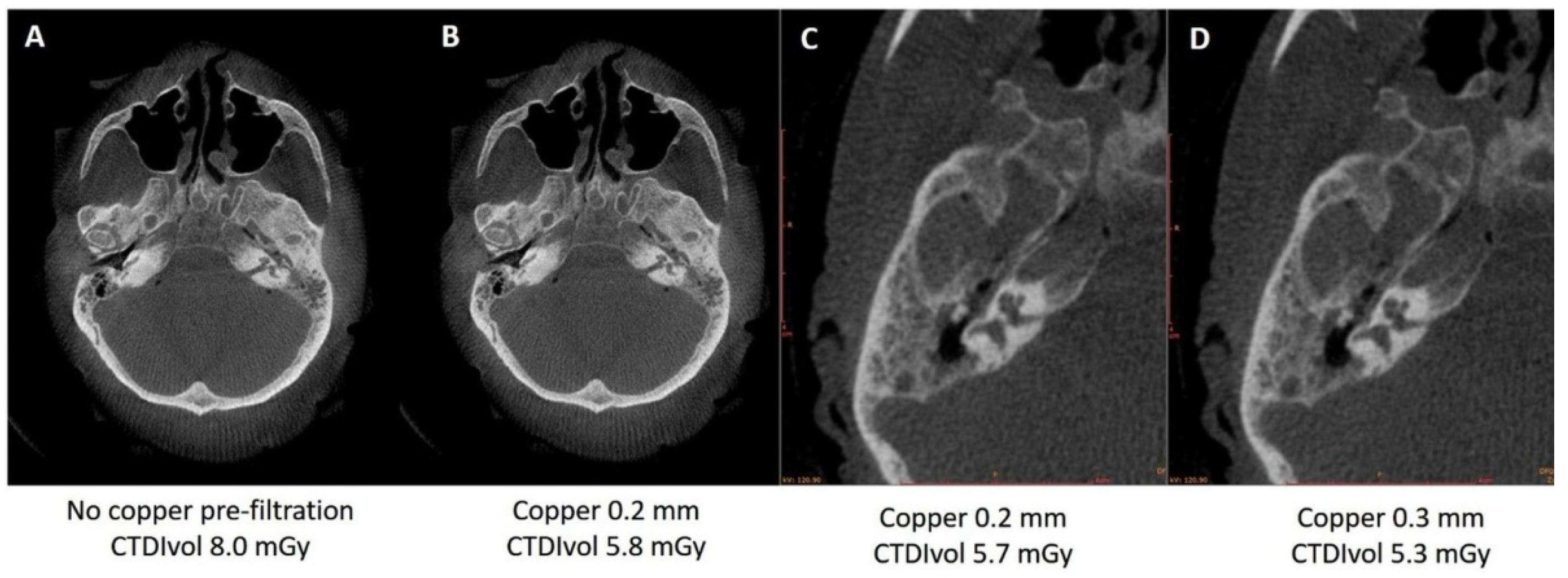 Applied Sciences Free Full Text Cone Beam Ct Imaging Of The Paranasal Region With A Multipurpose X Ray System Image Quality And Radiation Exposure Html