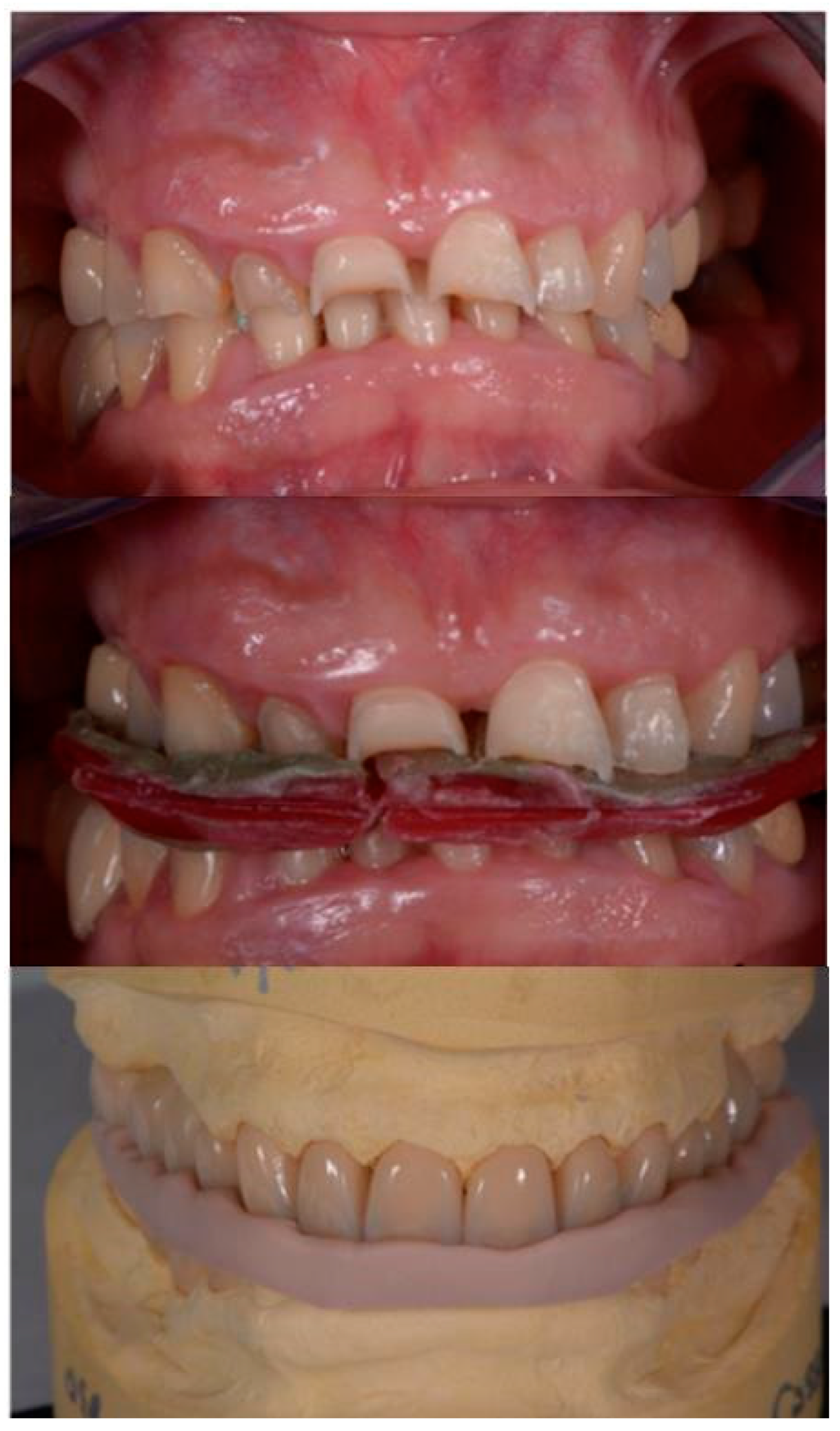 Applsci 10 06013 g004 Applsci 10 06013 g004