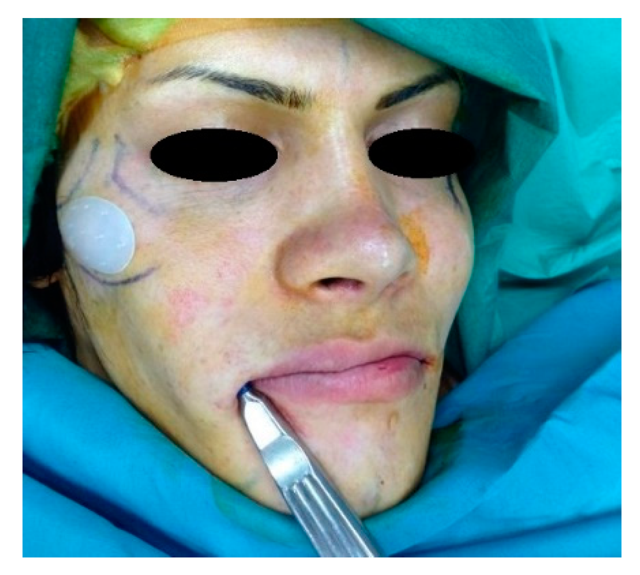 Applsci 10 06508 g001