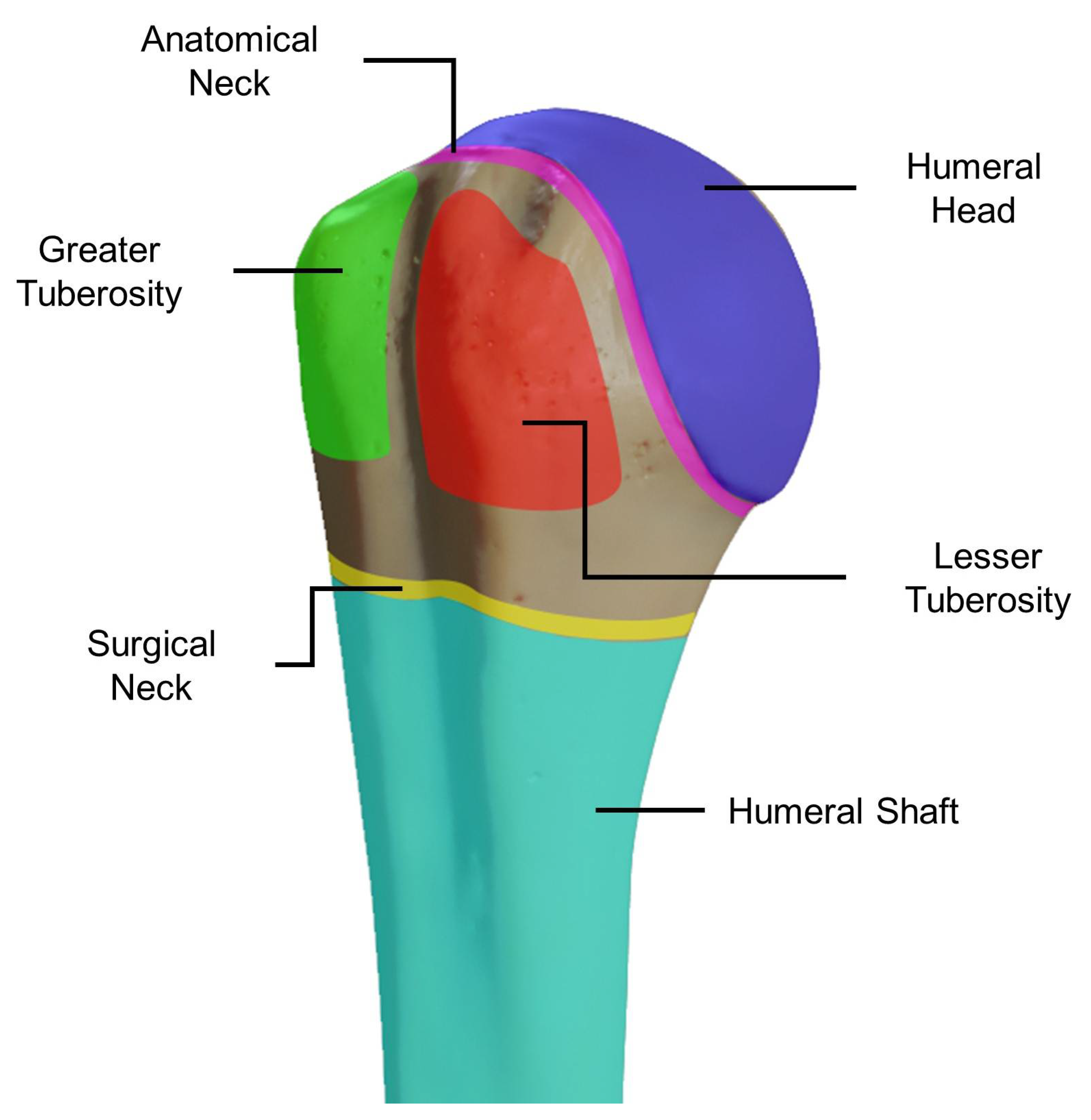 Surgical neck of the humerus - Wikipedia