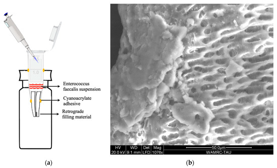 Representative images of a (A) 3-mm and (B) 6-mm apical plug and