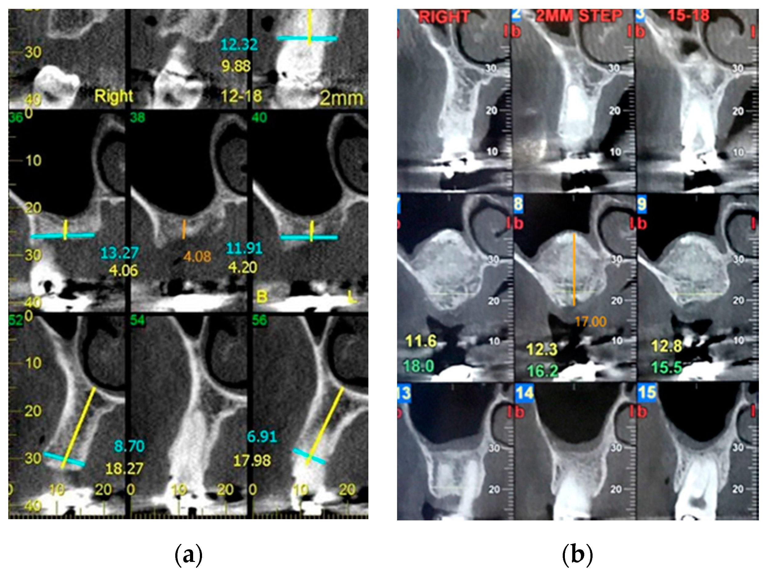 Applsci 10 07185 g002 Applsci 10 07185 g002
